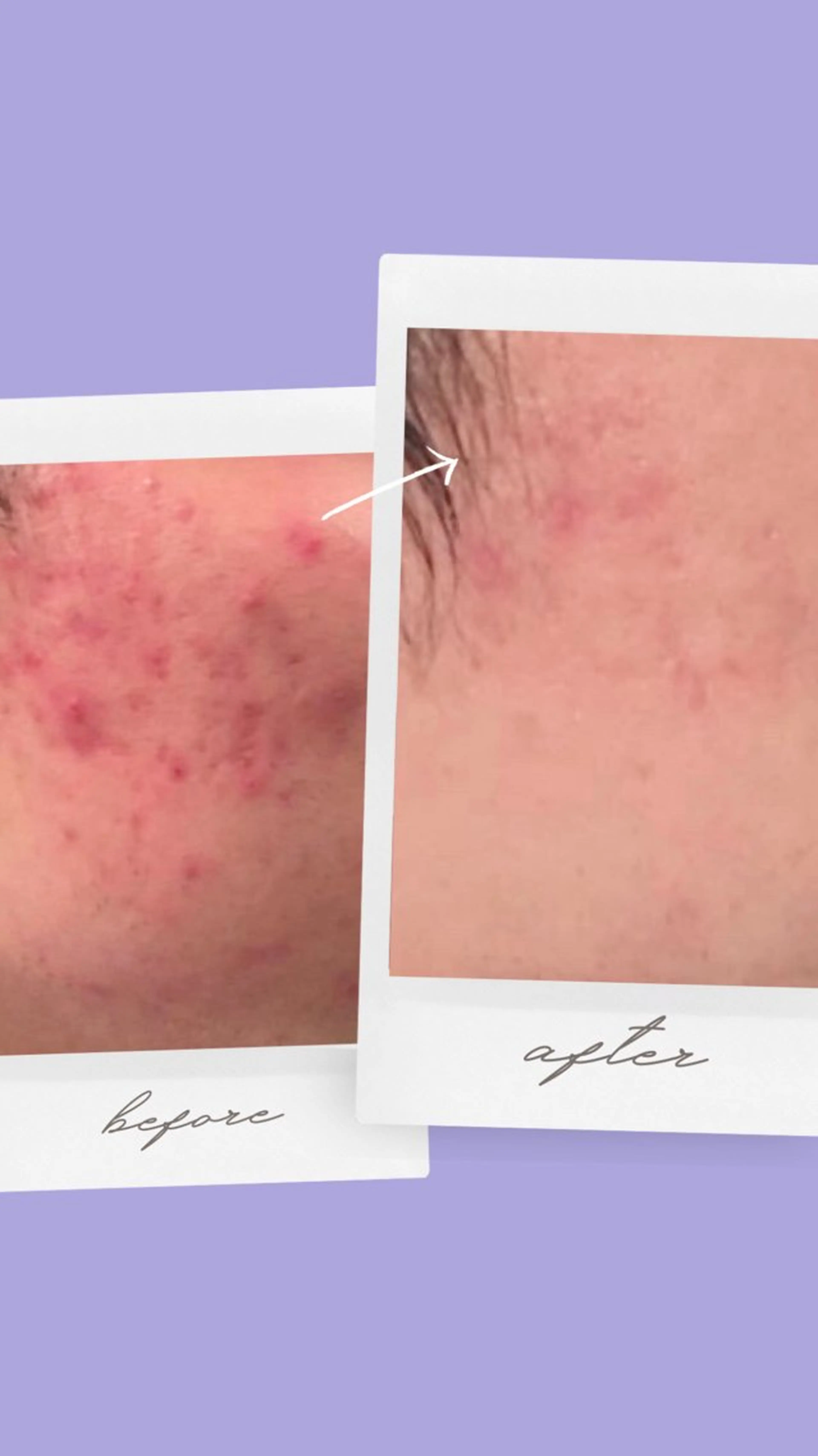 エステ ビューティーホリック 東金店のエステ・リラクイメージ