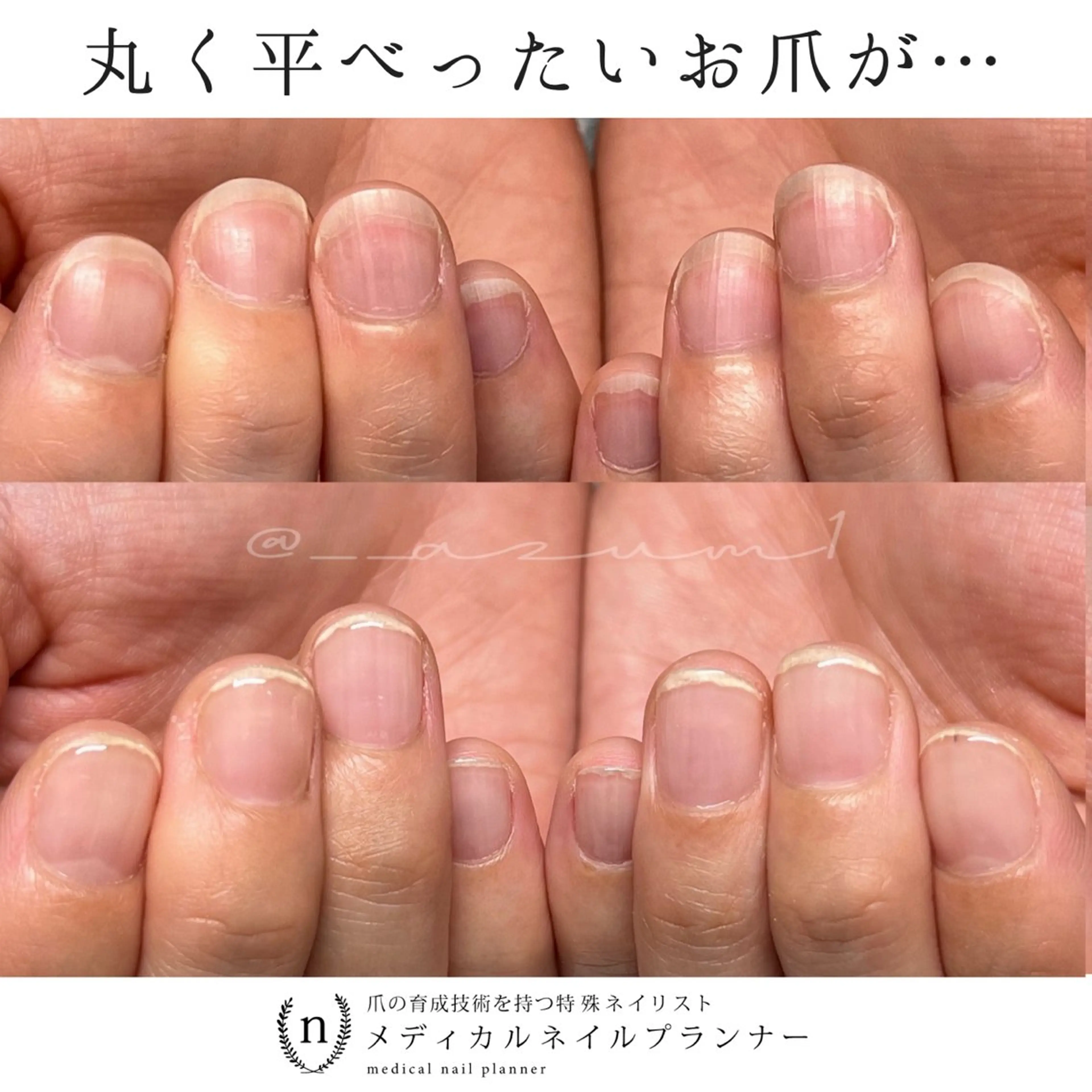 ネイル ハンドネイル ｎａｇｉ所属・自爪育成専門サロン ◌𓈒azumiのネイルデザイン