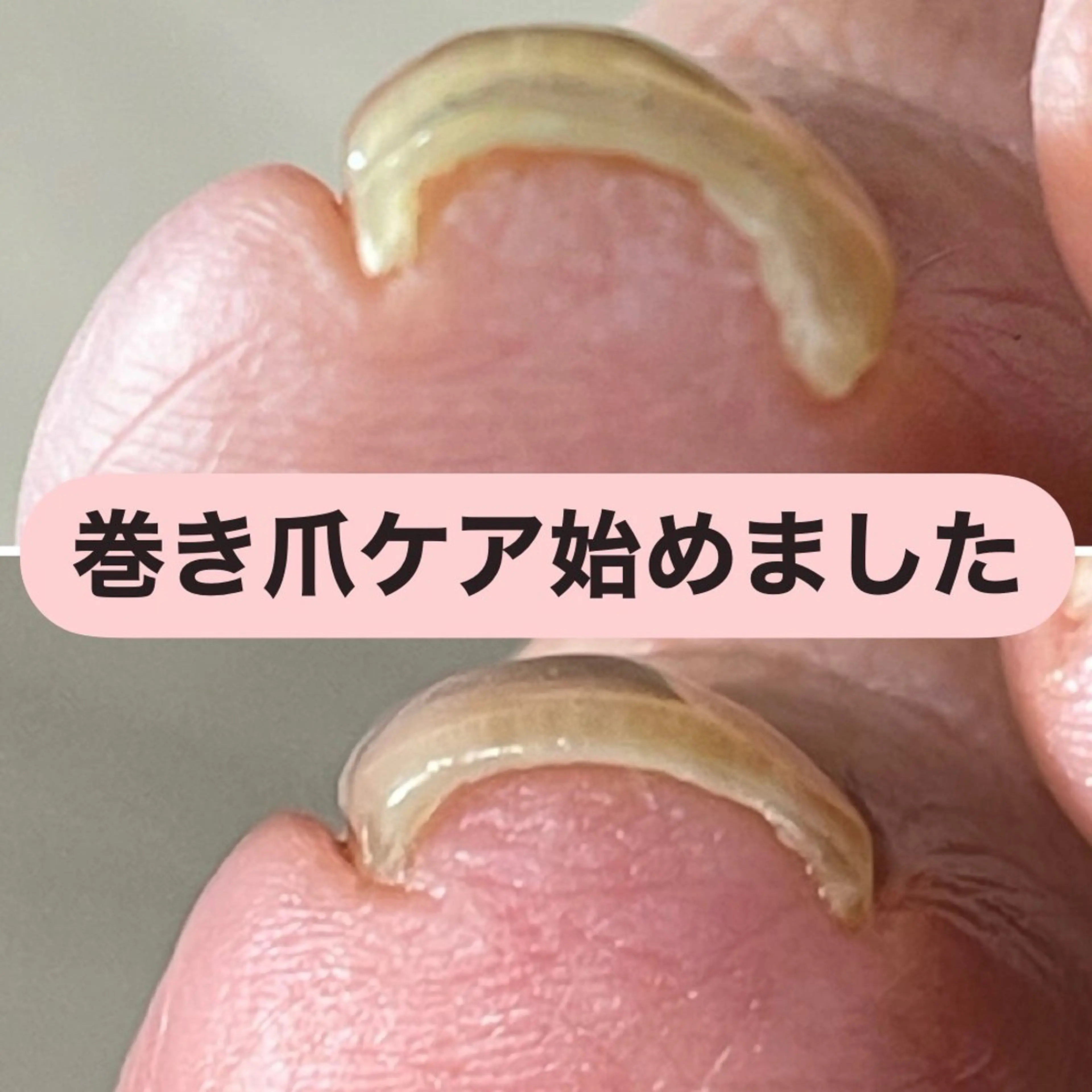 ネイル 深爪育成専門nail _Lumièlatのネイルデザイン