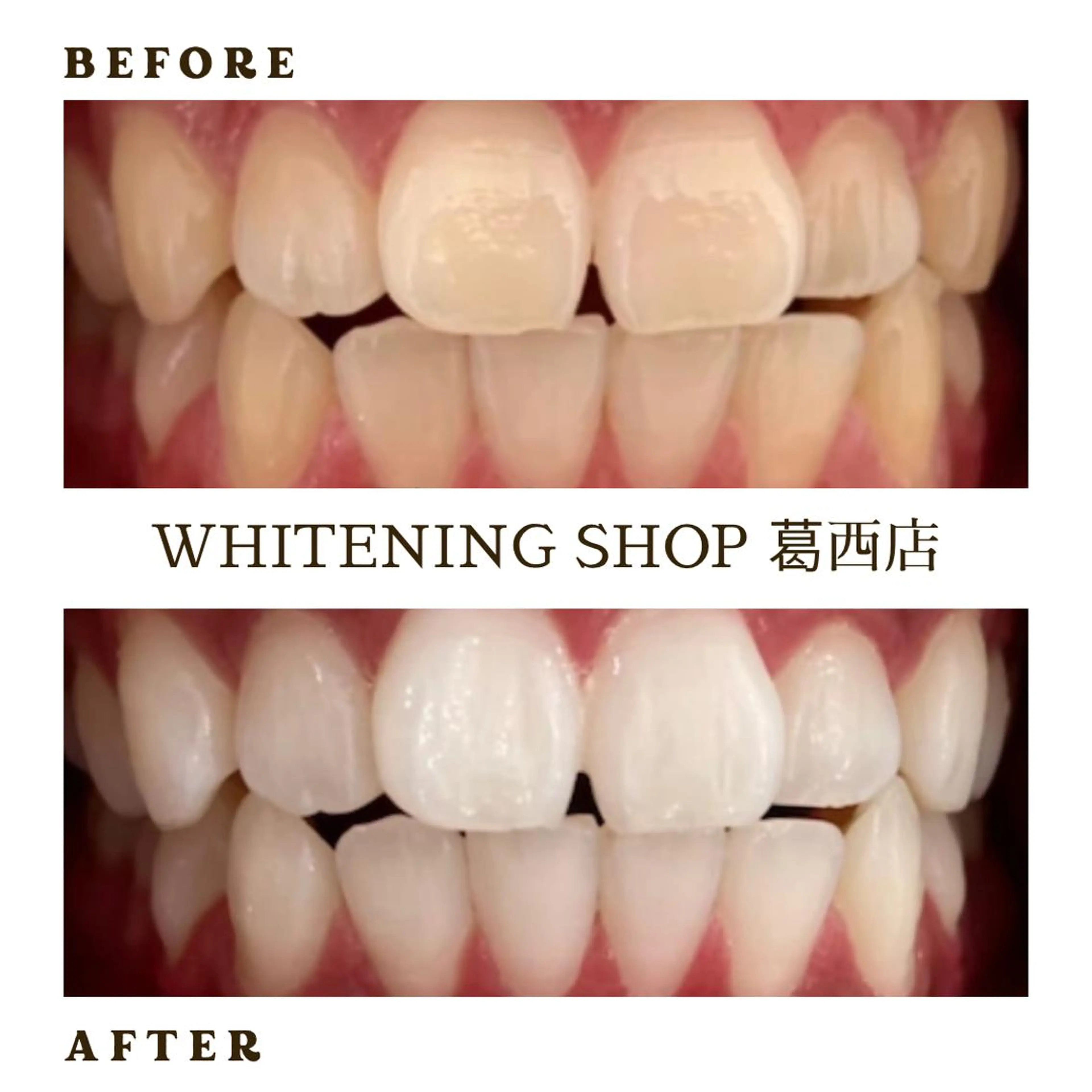 メンズ その他 ホワイトニング ショップ葛西店のその他イメージ