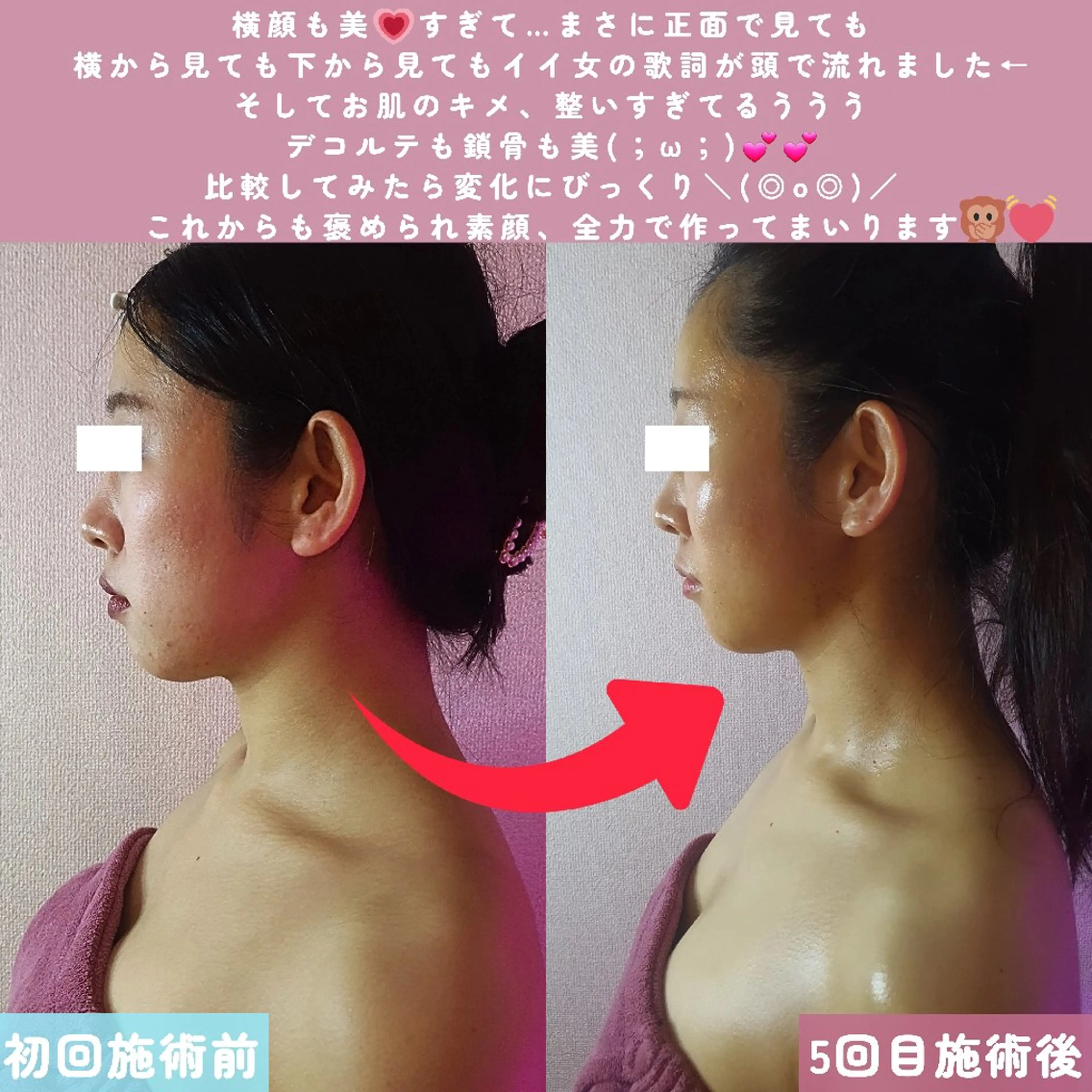 痩身ハーブピーリング 筋膜リリース☆B&Hのエステ・リラクイメージ