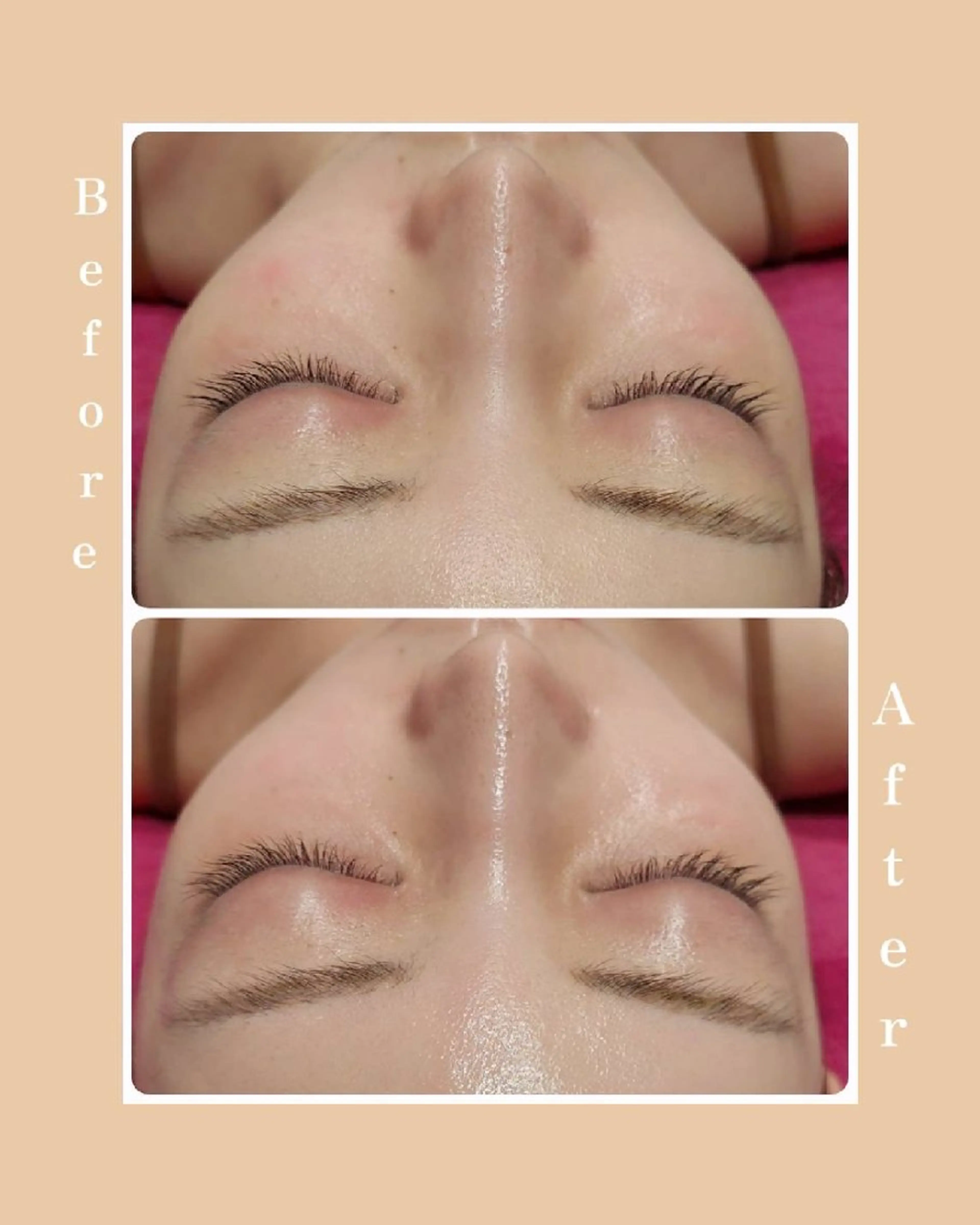 MyFairLady miuのエステ・リラクイメージ