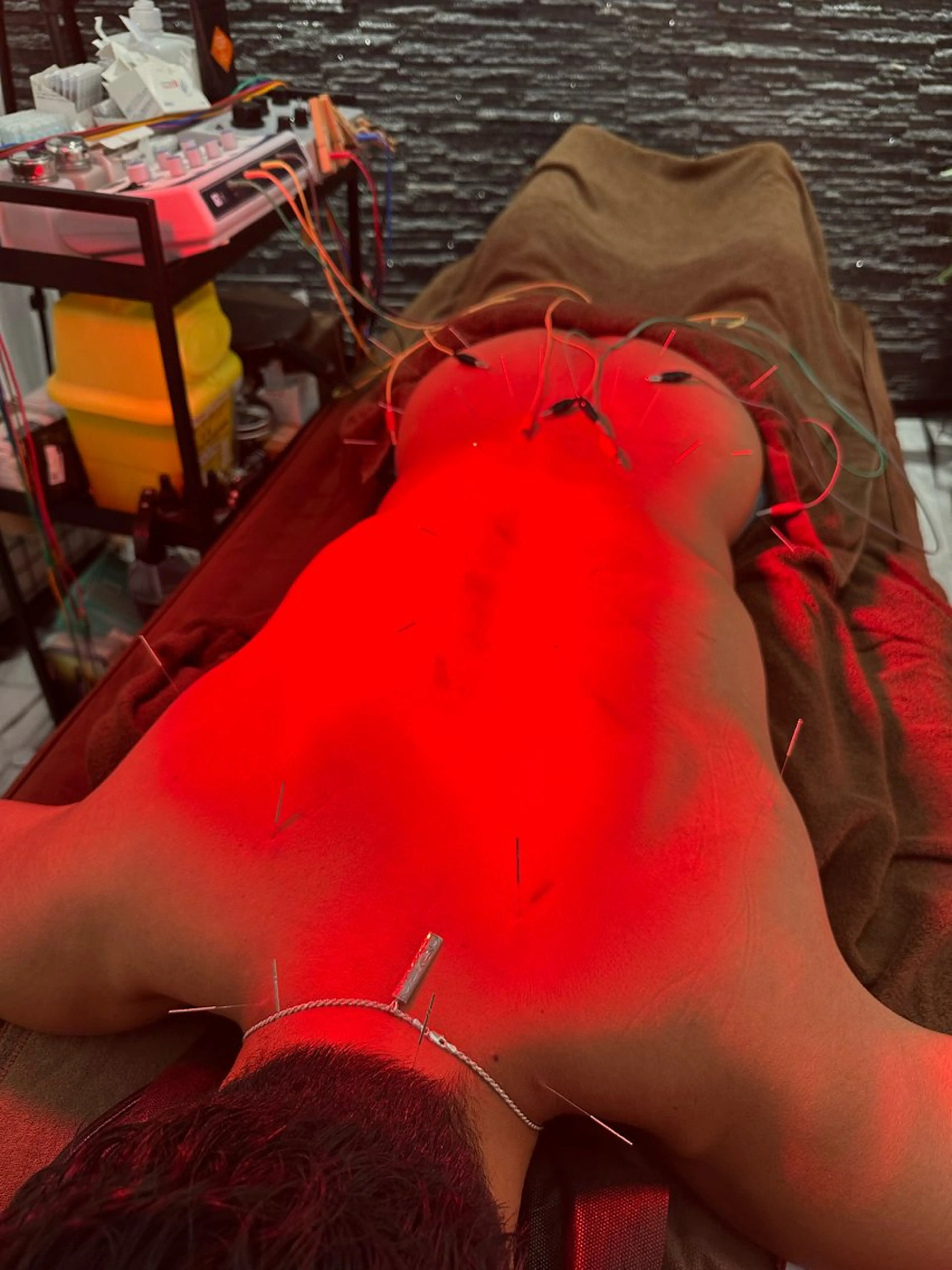 その他 小顔矯/美容鍼/鍼灸 BeauJuのその他イメージ