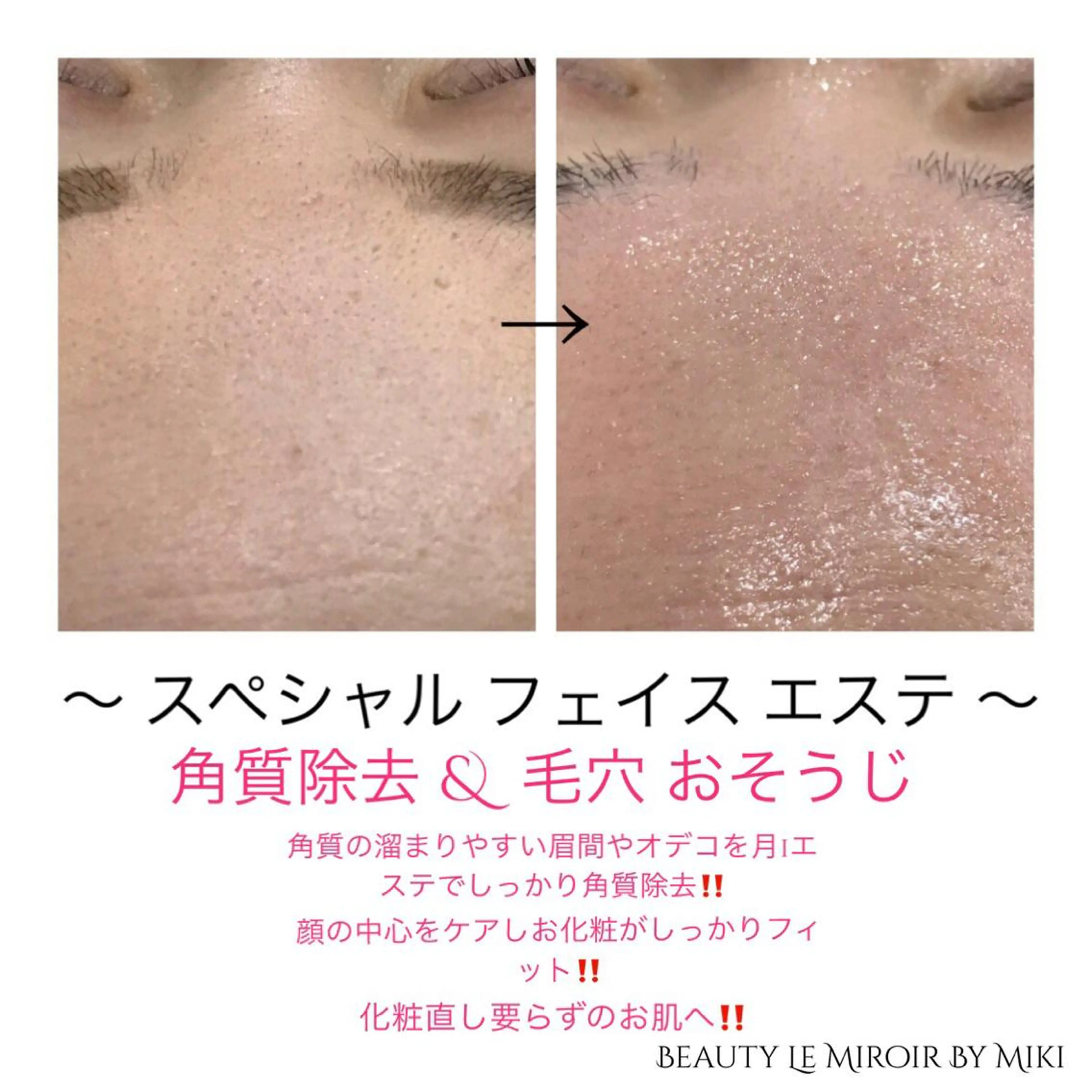 ビューティー ミロワールのエステ・リラクイメージ