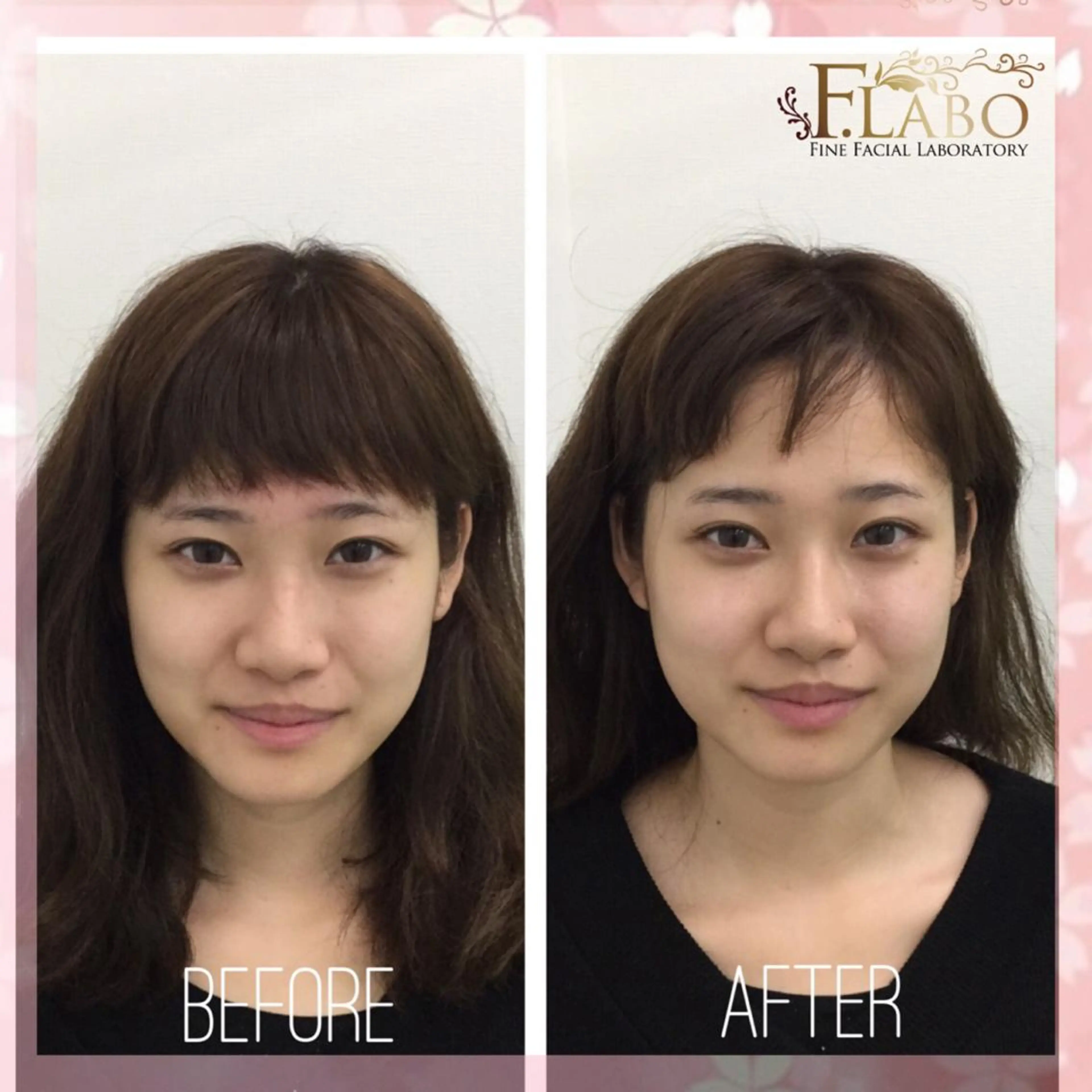 小顔&ダイエットジム エステ担当REIKOのその他イメージ