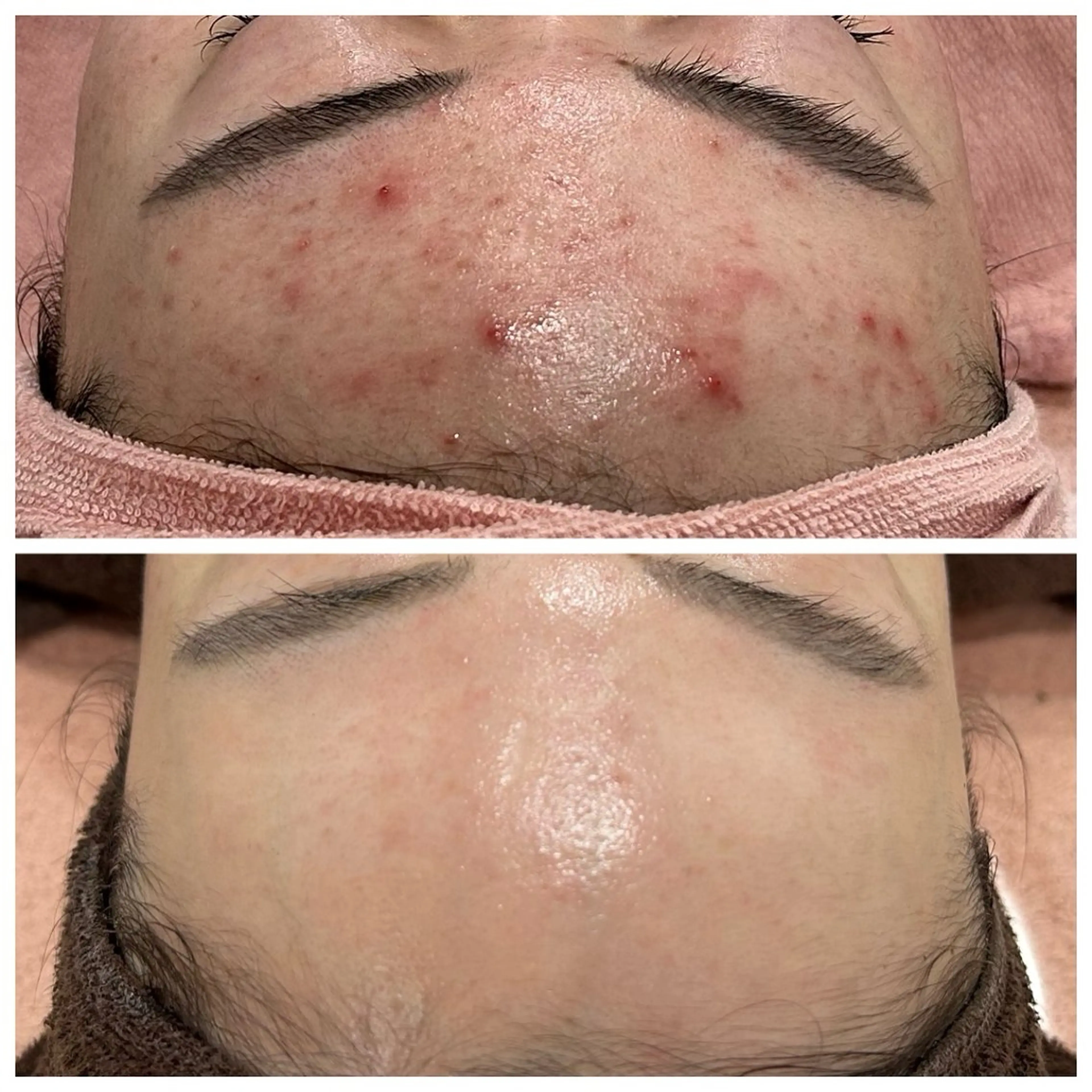 【現役看護師】高来 笑子のエステ・リラクイメージ