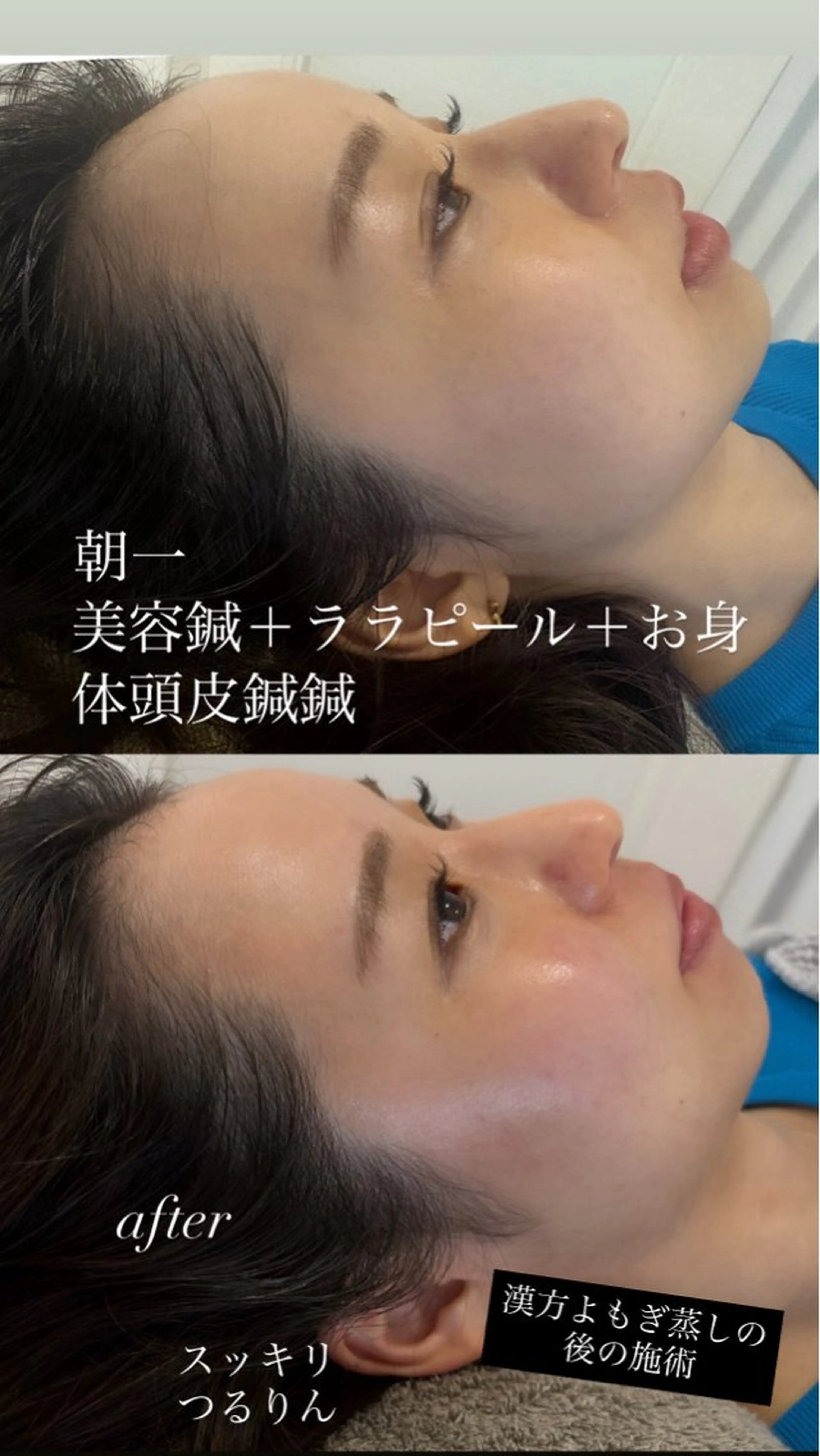 エステ リラク 美容鍼灸サロン mahoroba院長のエステ・リラクイメージ