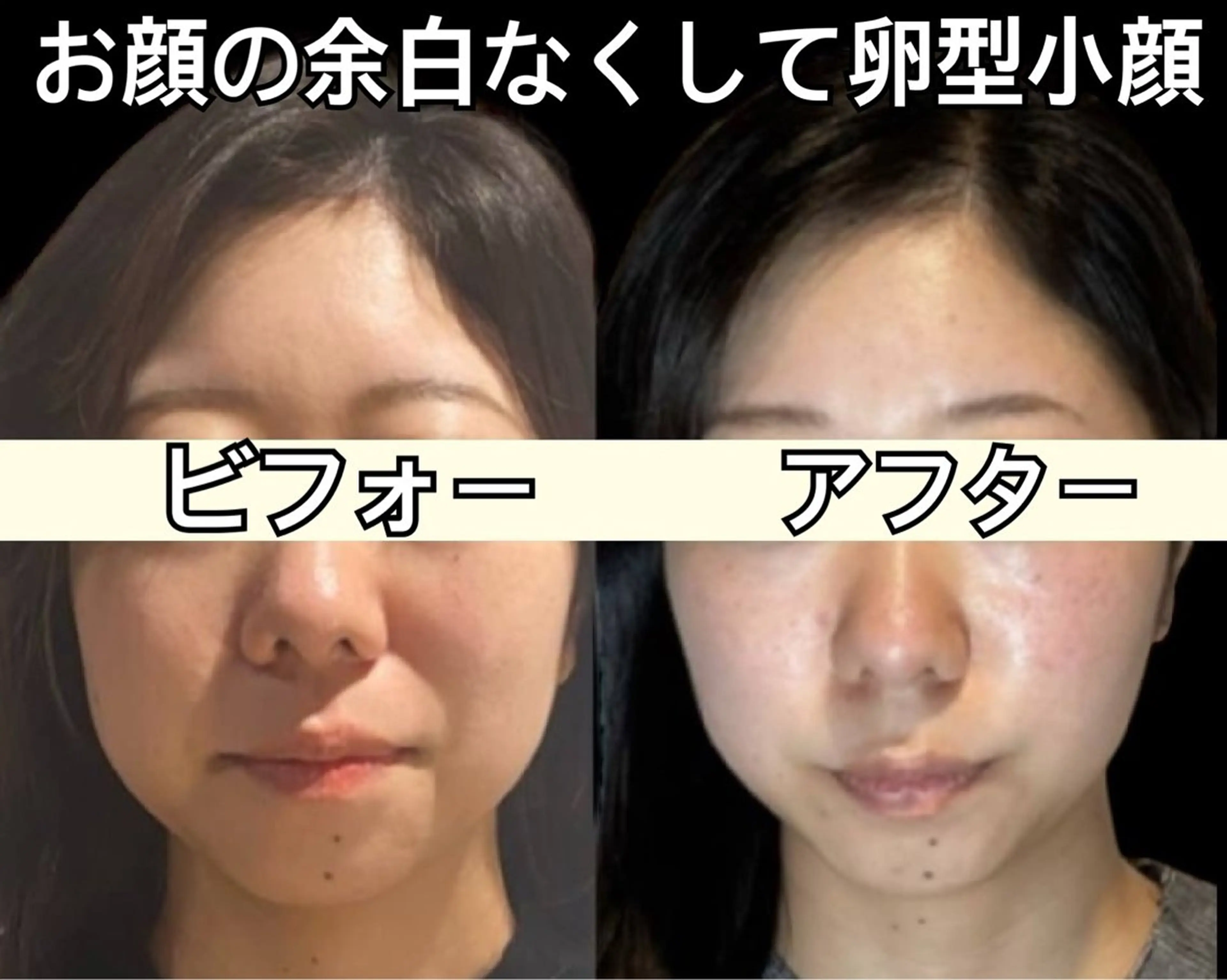 小顔専門看護師クリニカルサロンCOCO所属・小顔と美肌サロン クリニカルサロンココのエステ・リラクイメージ