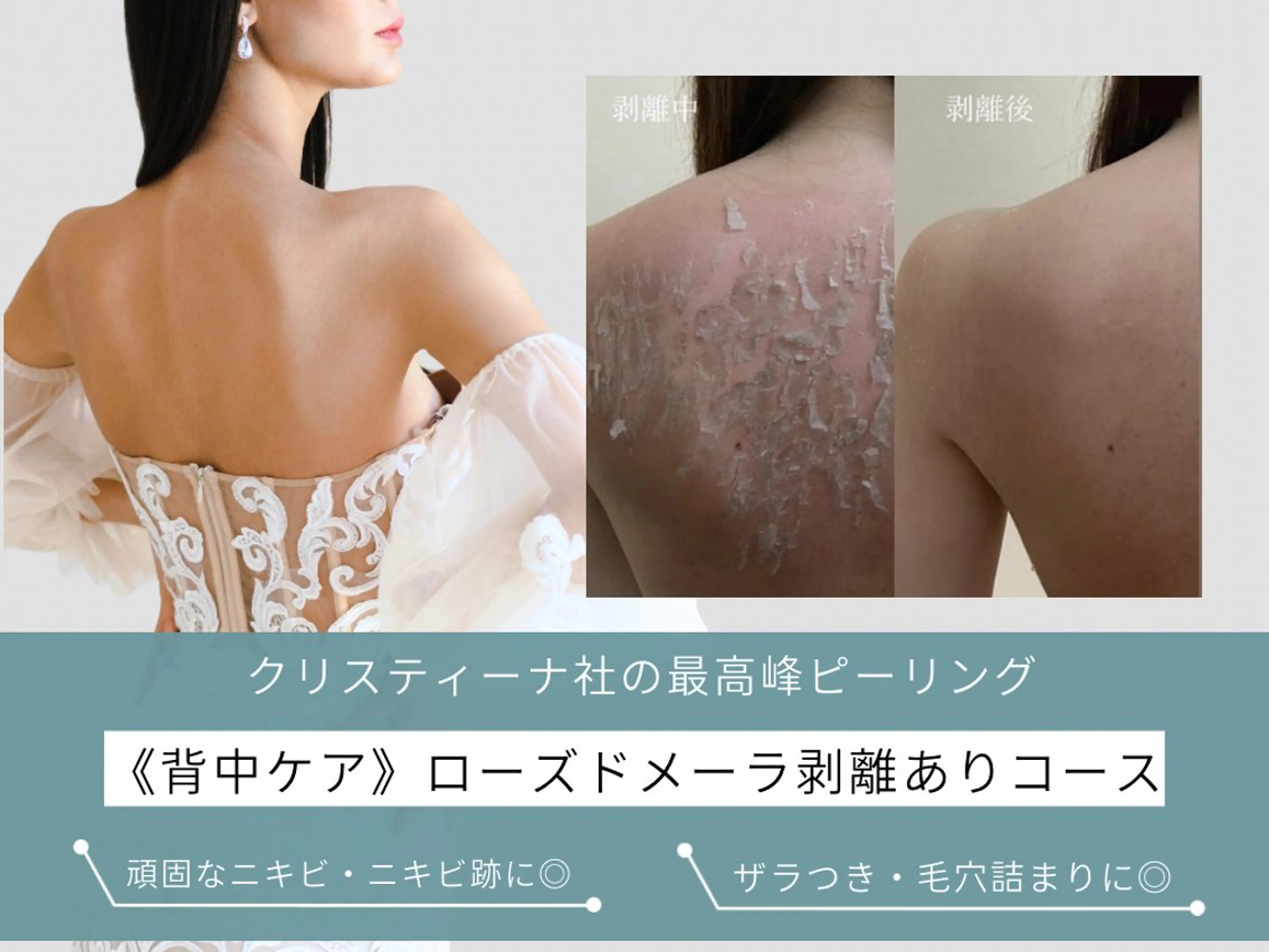 エステ 肌質改善ピーリング ✧BestBelleのエステ・リラクイメージ