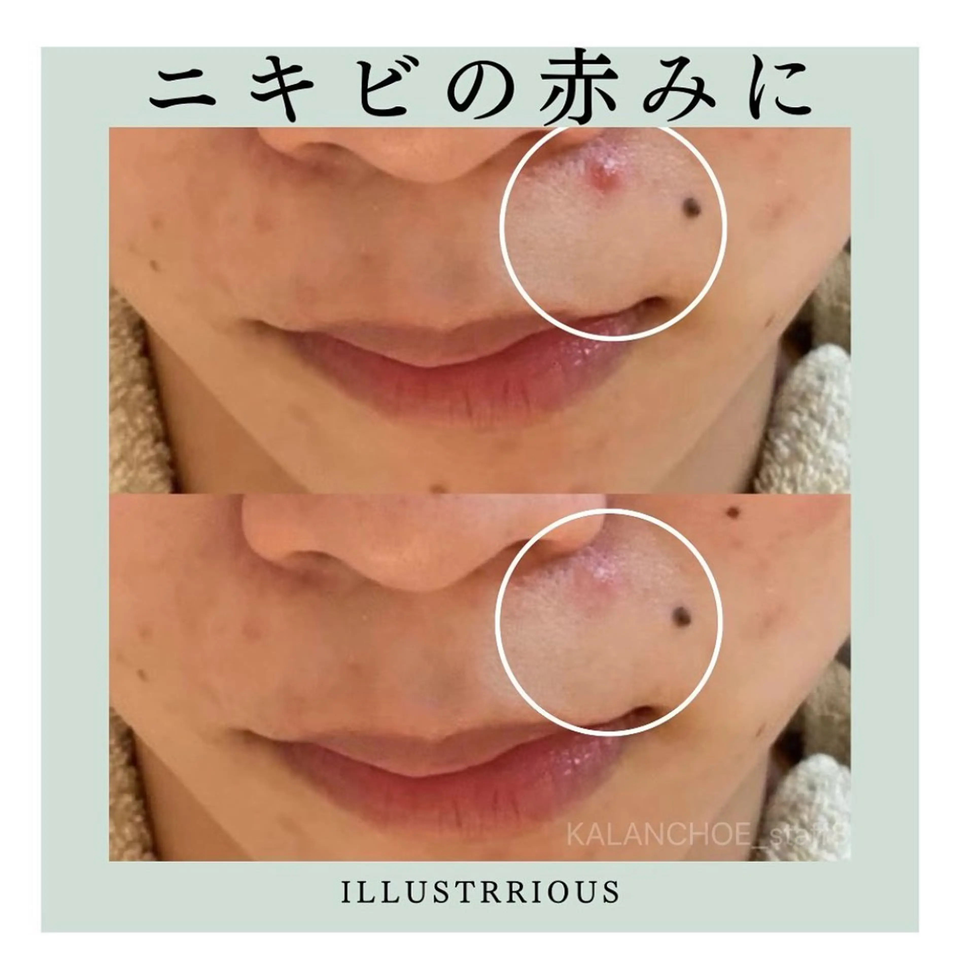 エステ 肌質改善 KALANCHOEのエステ・リラクイメージ