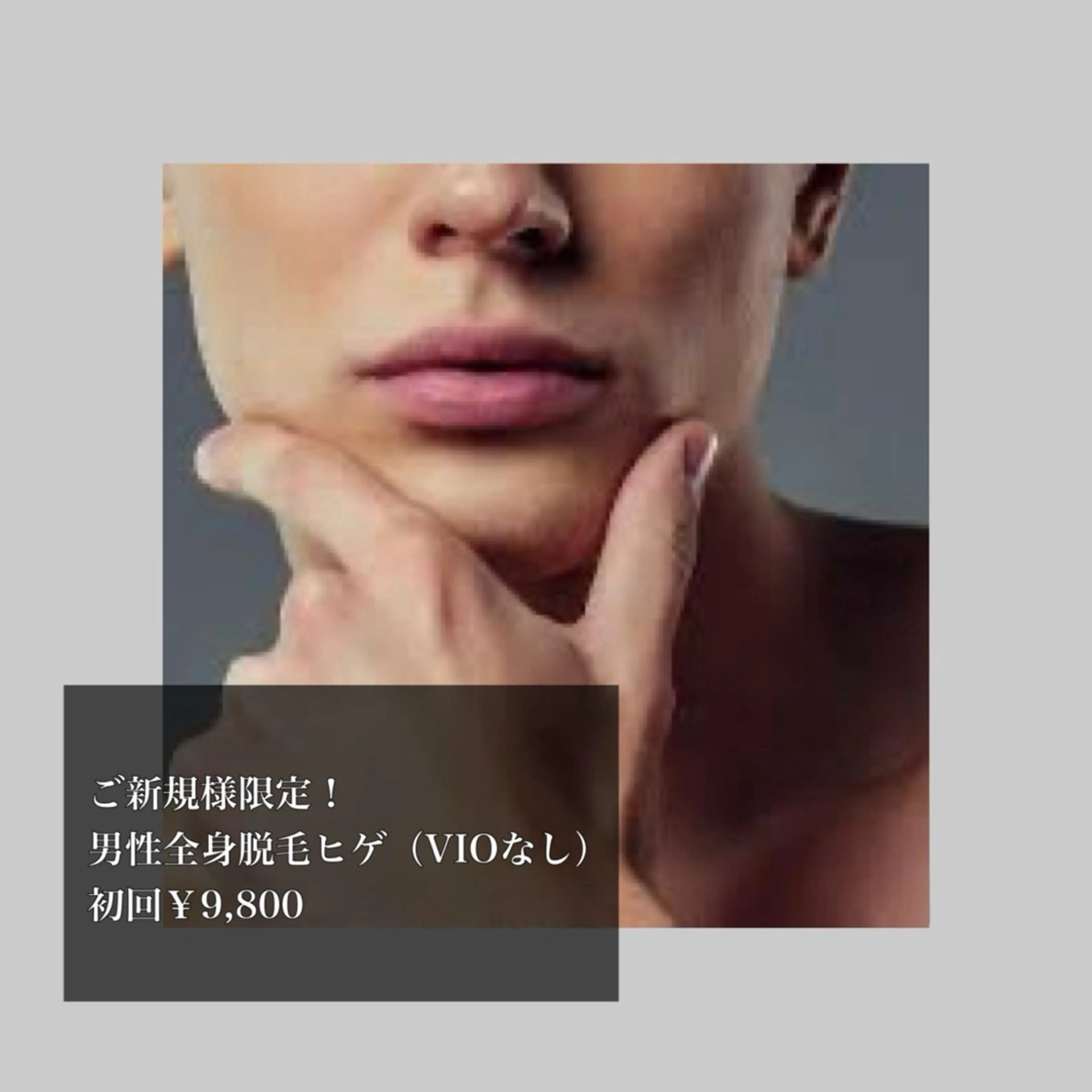 【メンズ】ヒゲ＋全身脱毛（VIOなし）🐾の写真