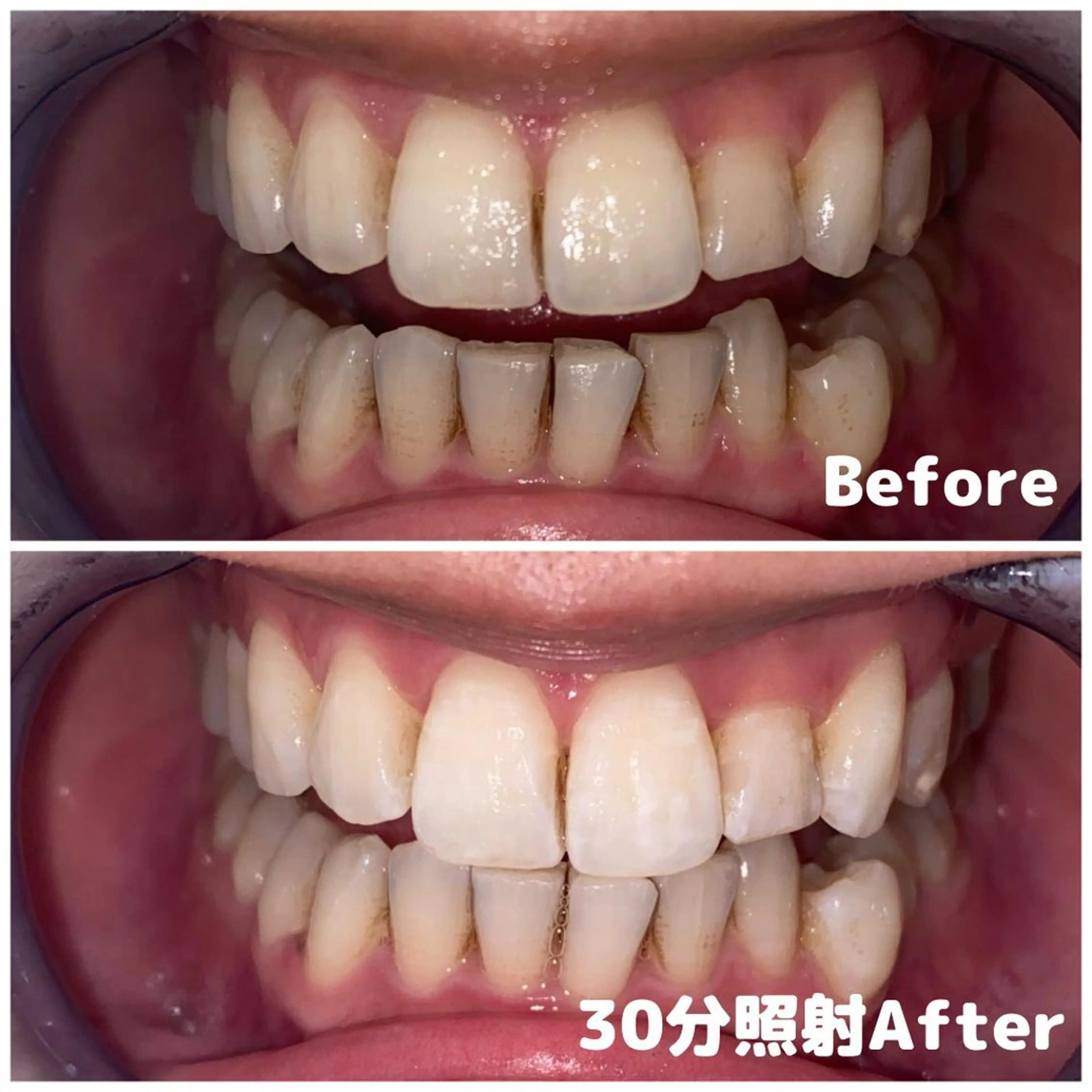 その他 ライトビューティー 関内店のその他イメージ