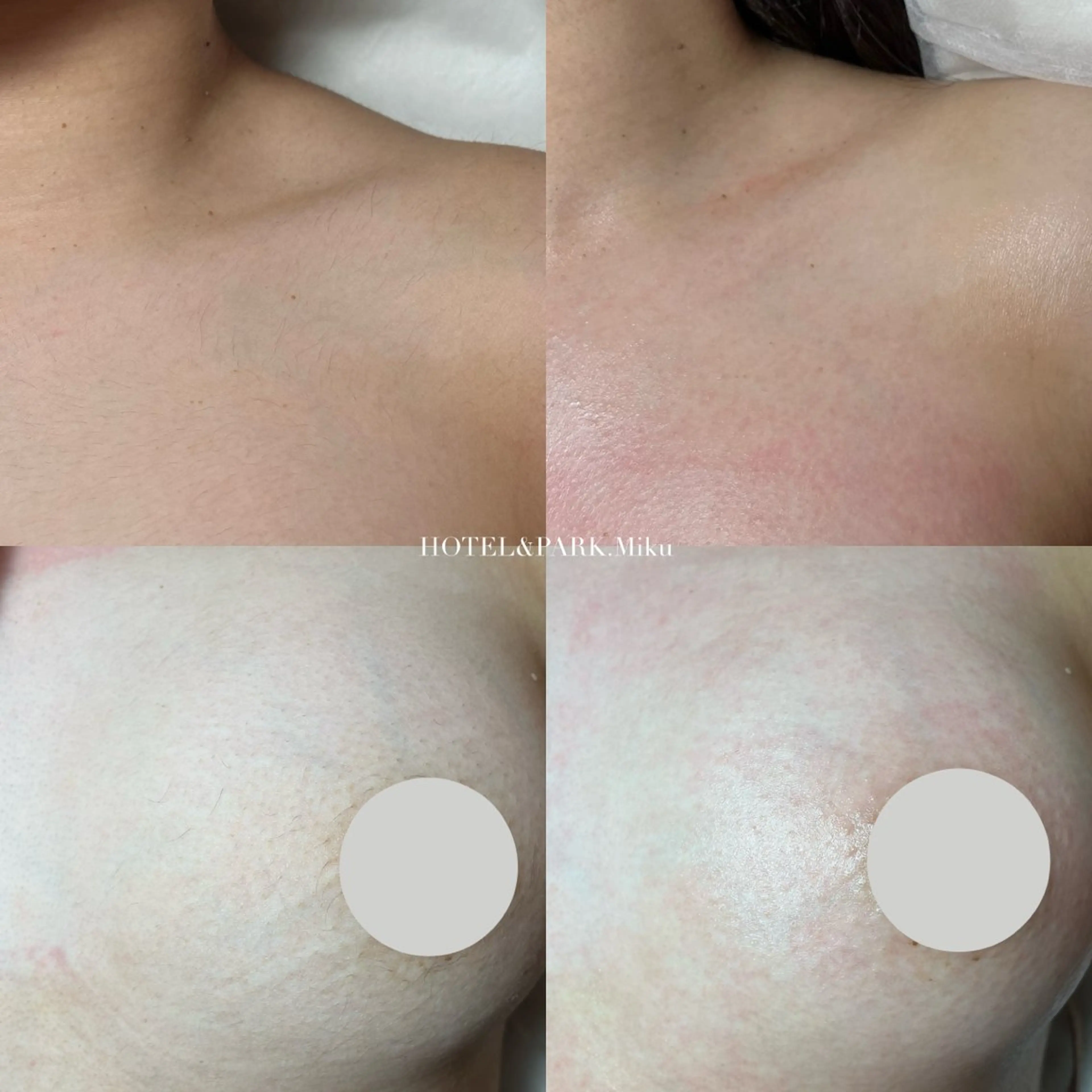 HOTEL&PARK Mikuワックス脱毛のエステ・リラクイメージ