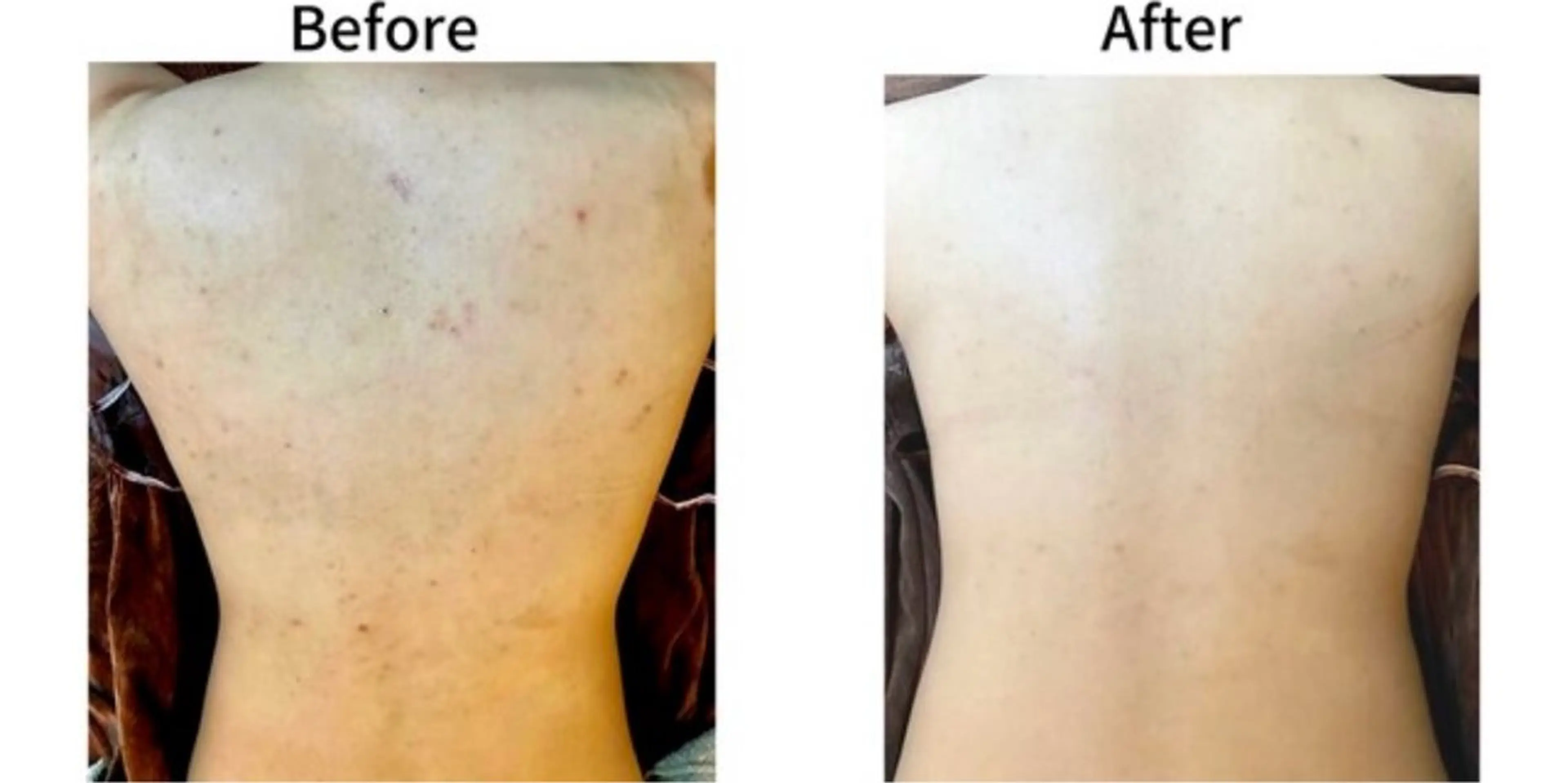 エステ 脱毛&フェイシャル 専門店muro.のエステ・リラクイメージ