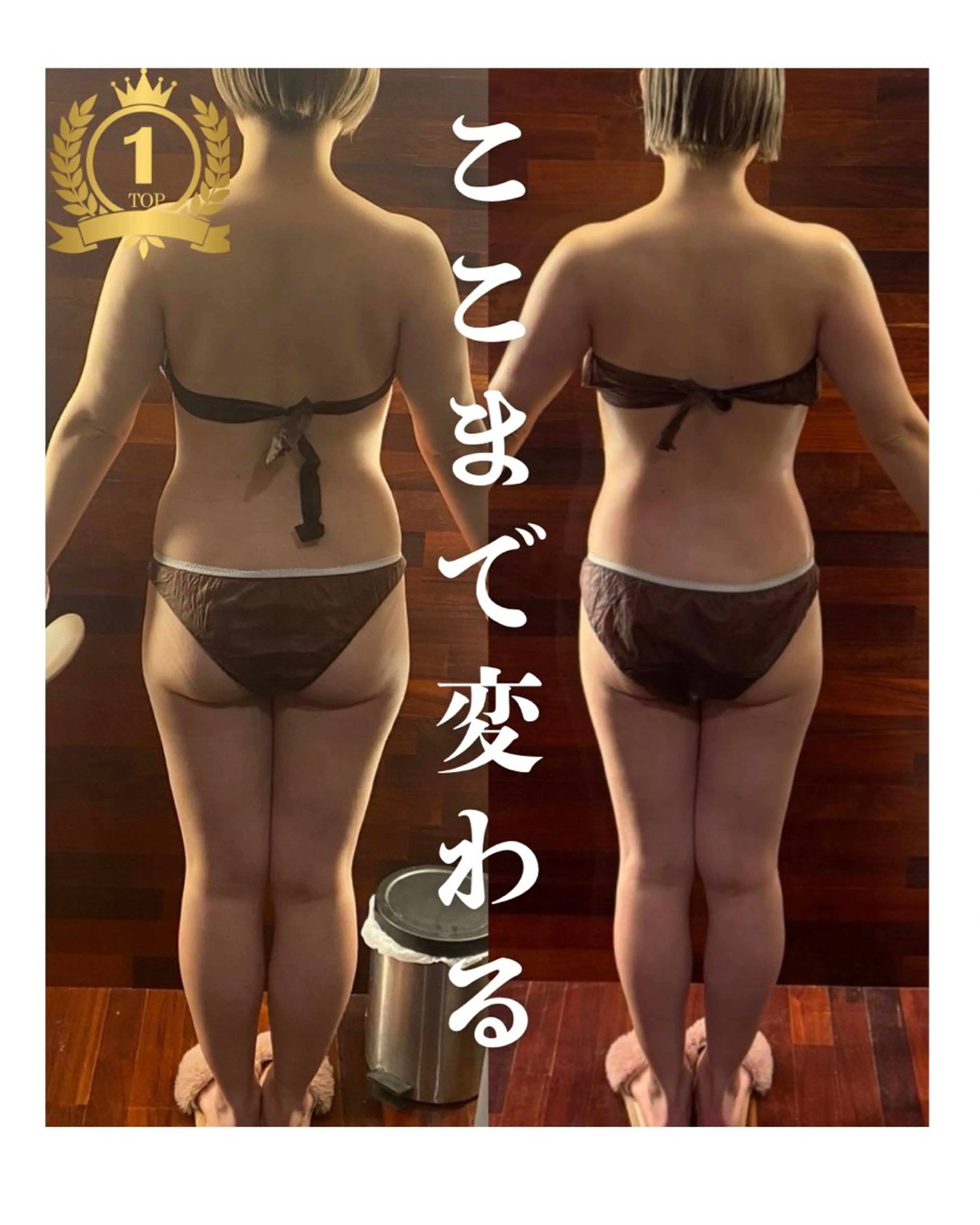 【誰でも美脚🦵🏼機械×ハンド】足痩せしたい方へ★の写真