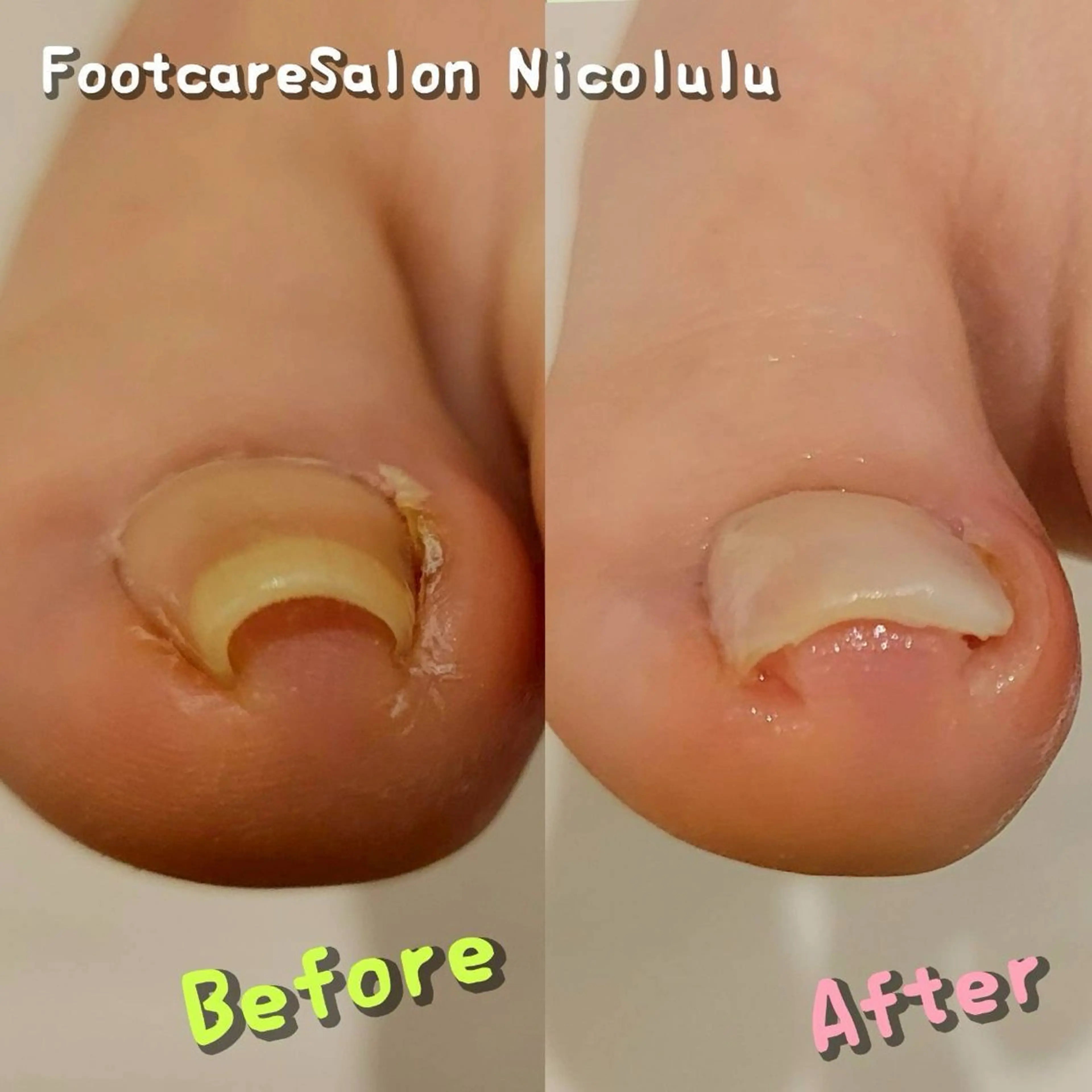 足トラブル専門 ニコルル金沢のエステ・リラクイメージ