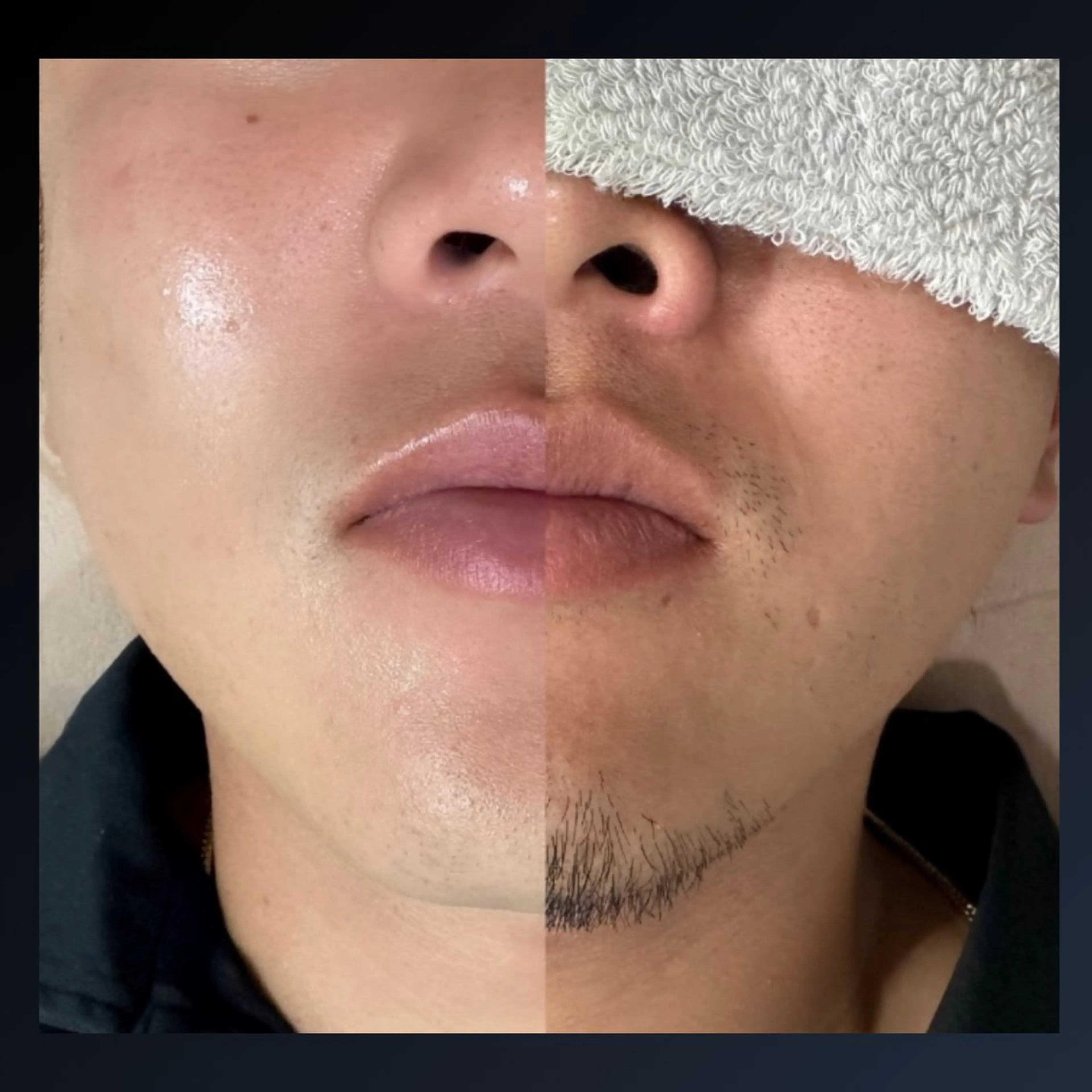 メンズ 脱毛＆眉毛サロン メンズ専用Grastの眉毛・アイブロウイメージ