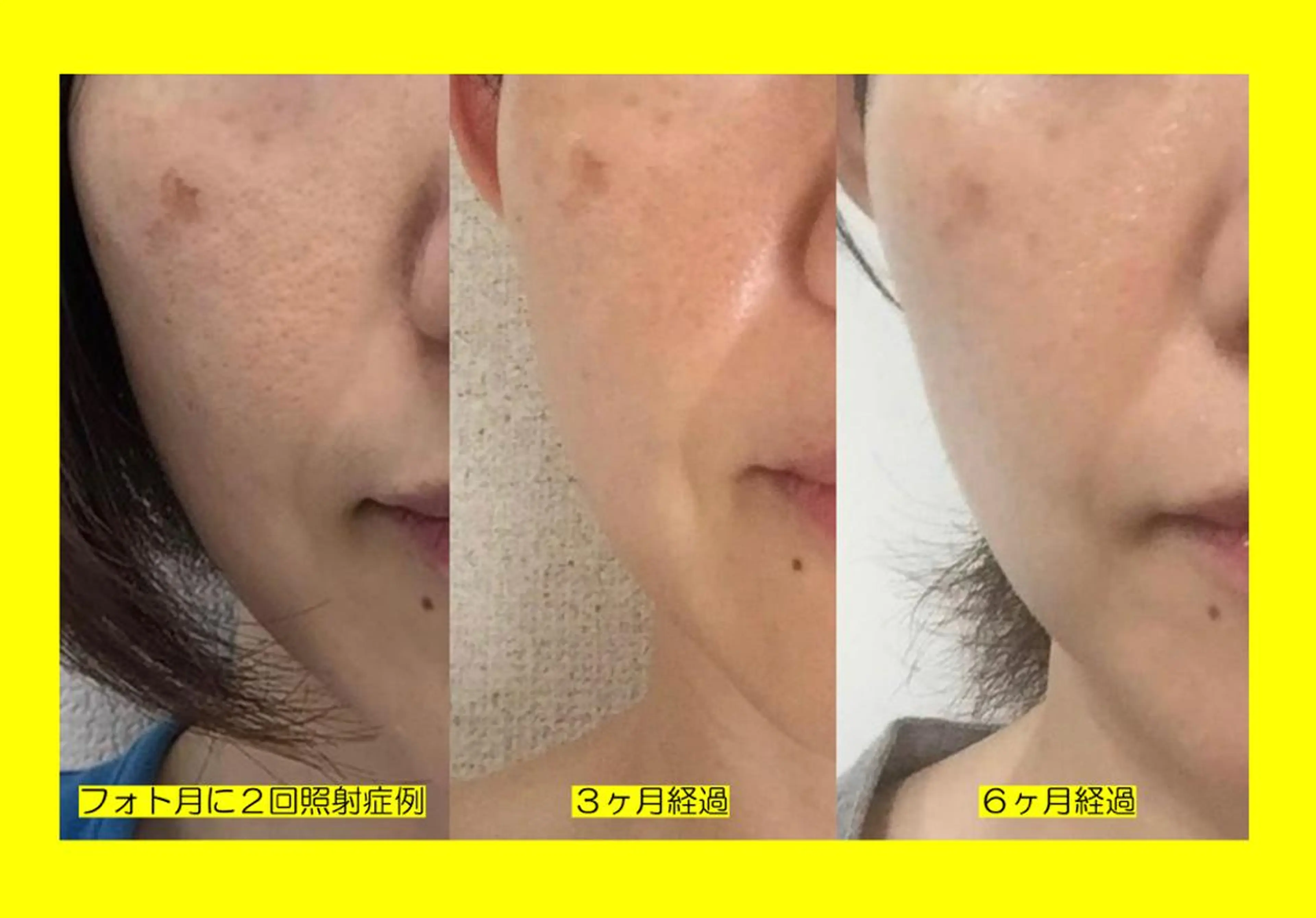 痩身/美肌/脱毛 MAX BEAUTYのエステ・リラクイメージ