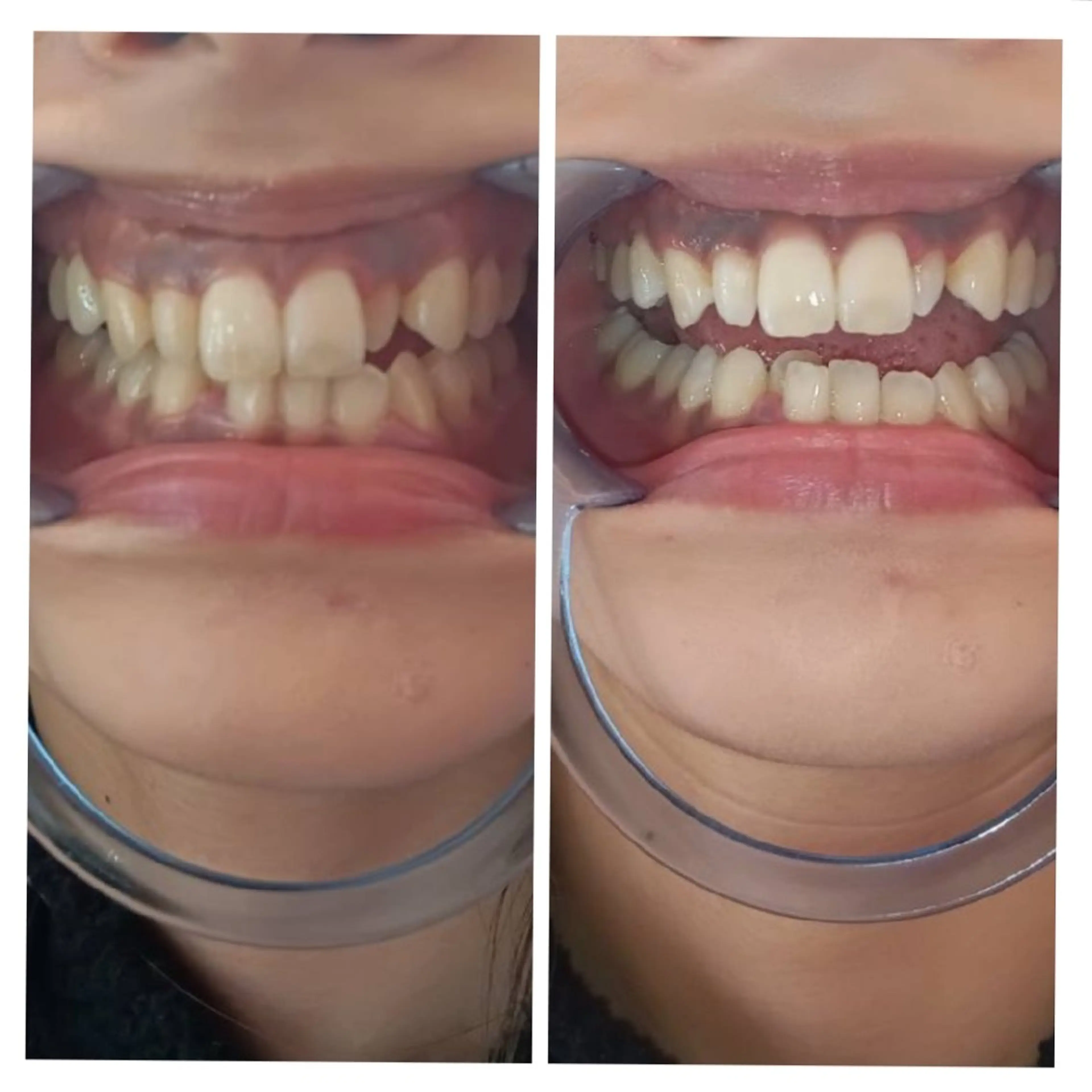 エステ A-family  kaoriのエステ・リラクイメージ