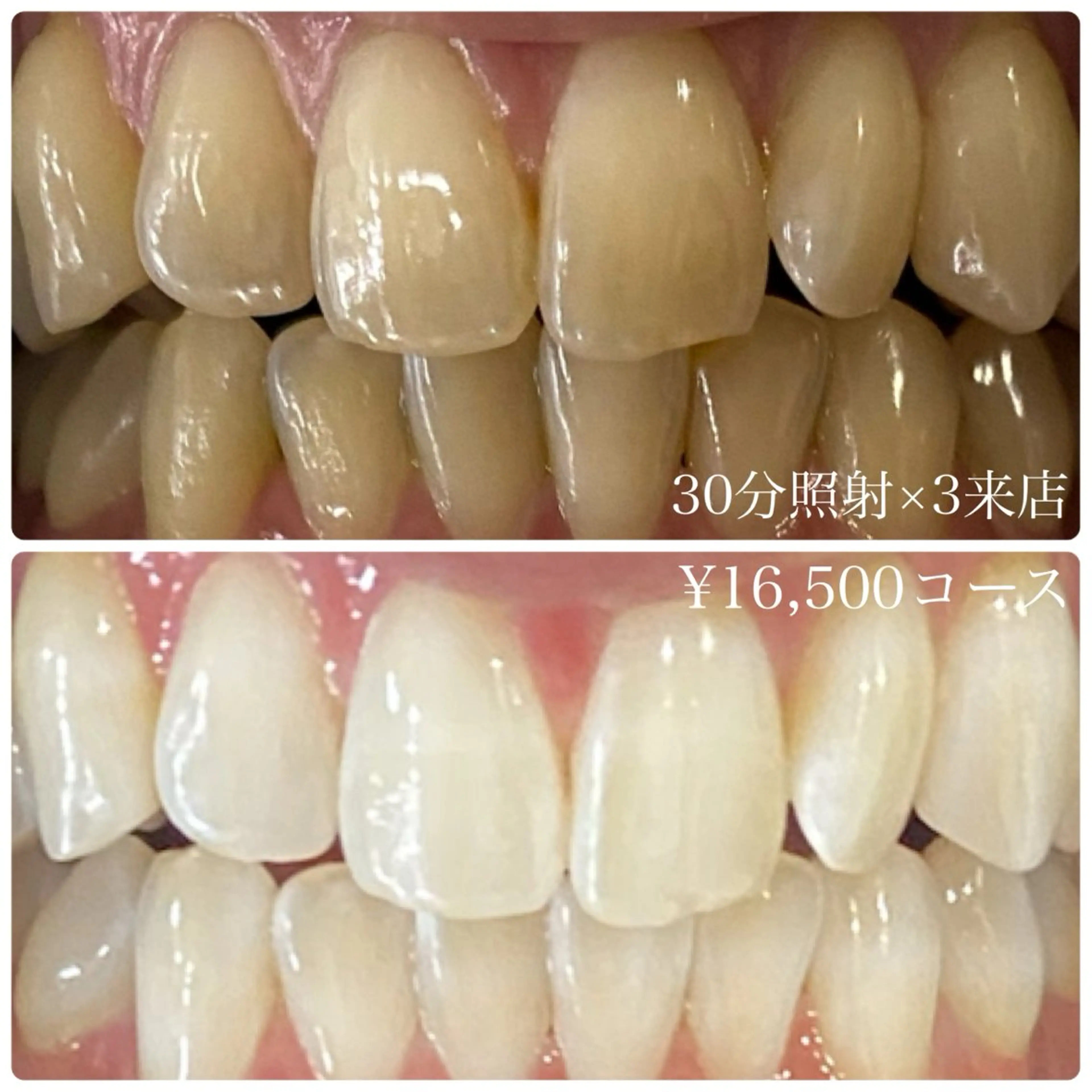 メンズ ホワイトニング ルーム　川崎店のその他イメージ