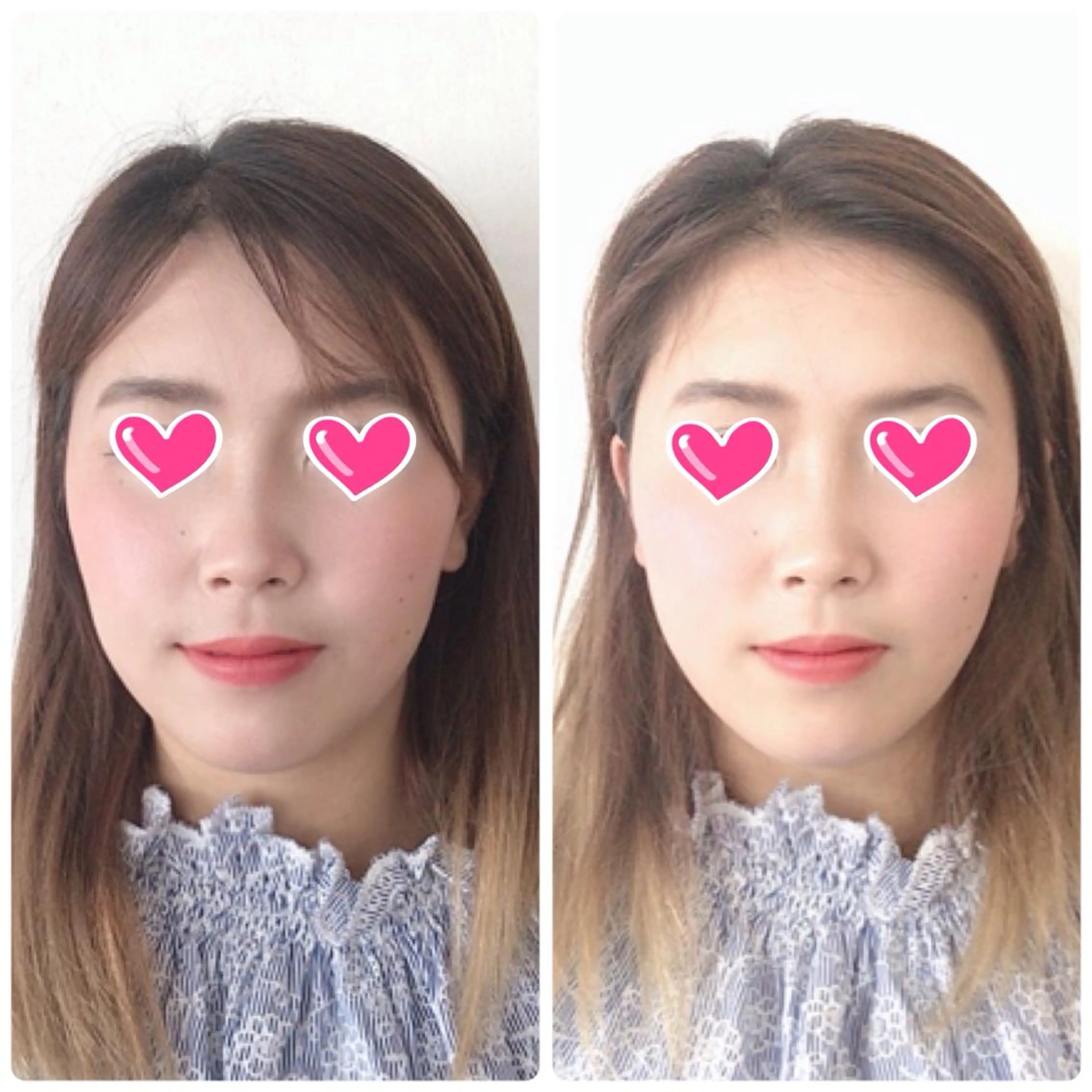 調律エステ /美KISSのその他イメージ