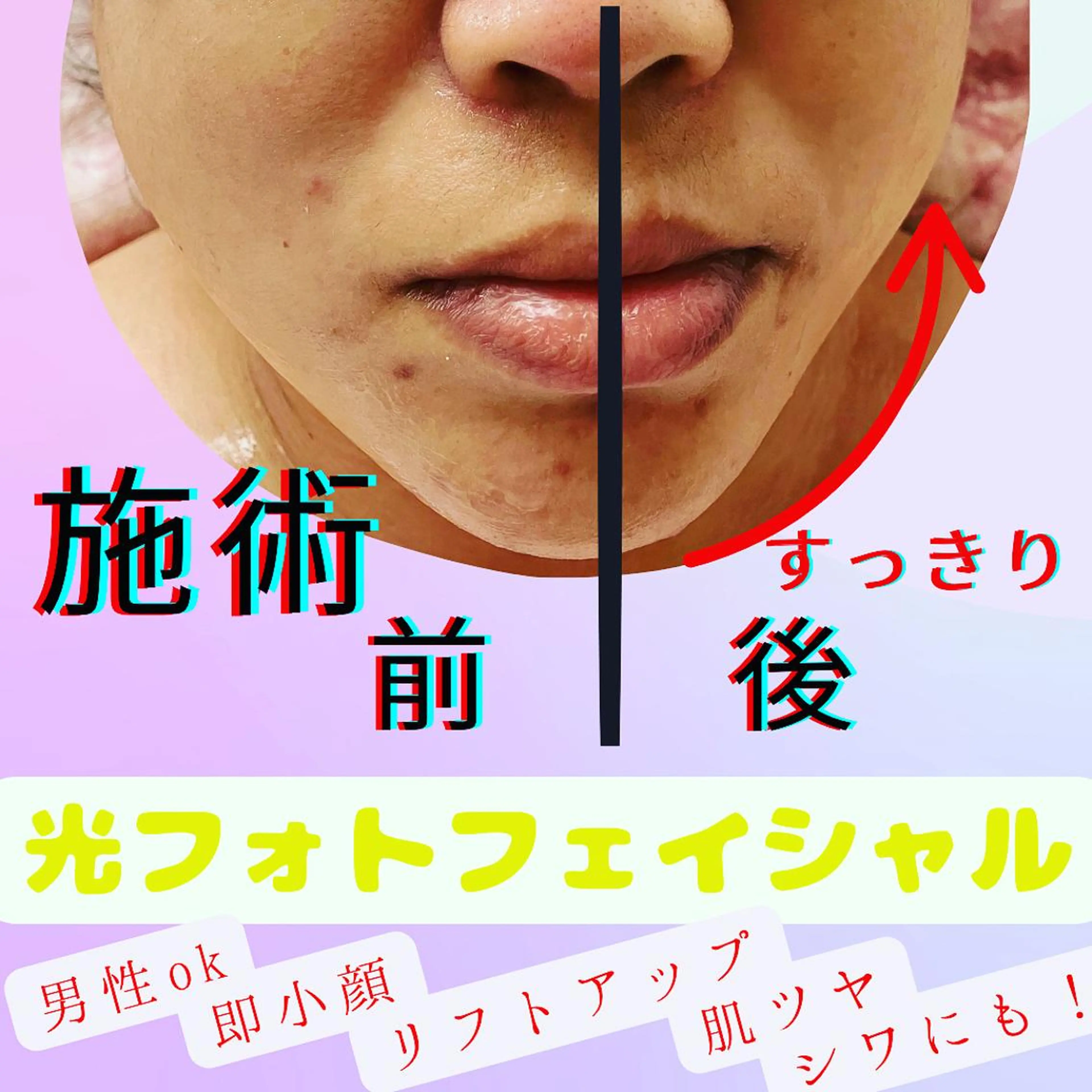 その他 LUMINAルミナ 【肌管理サロン】のその他イメージ