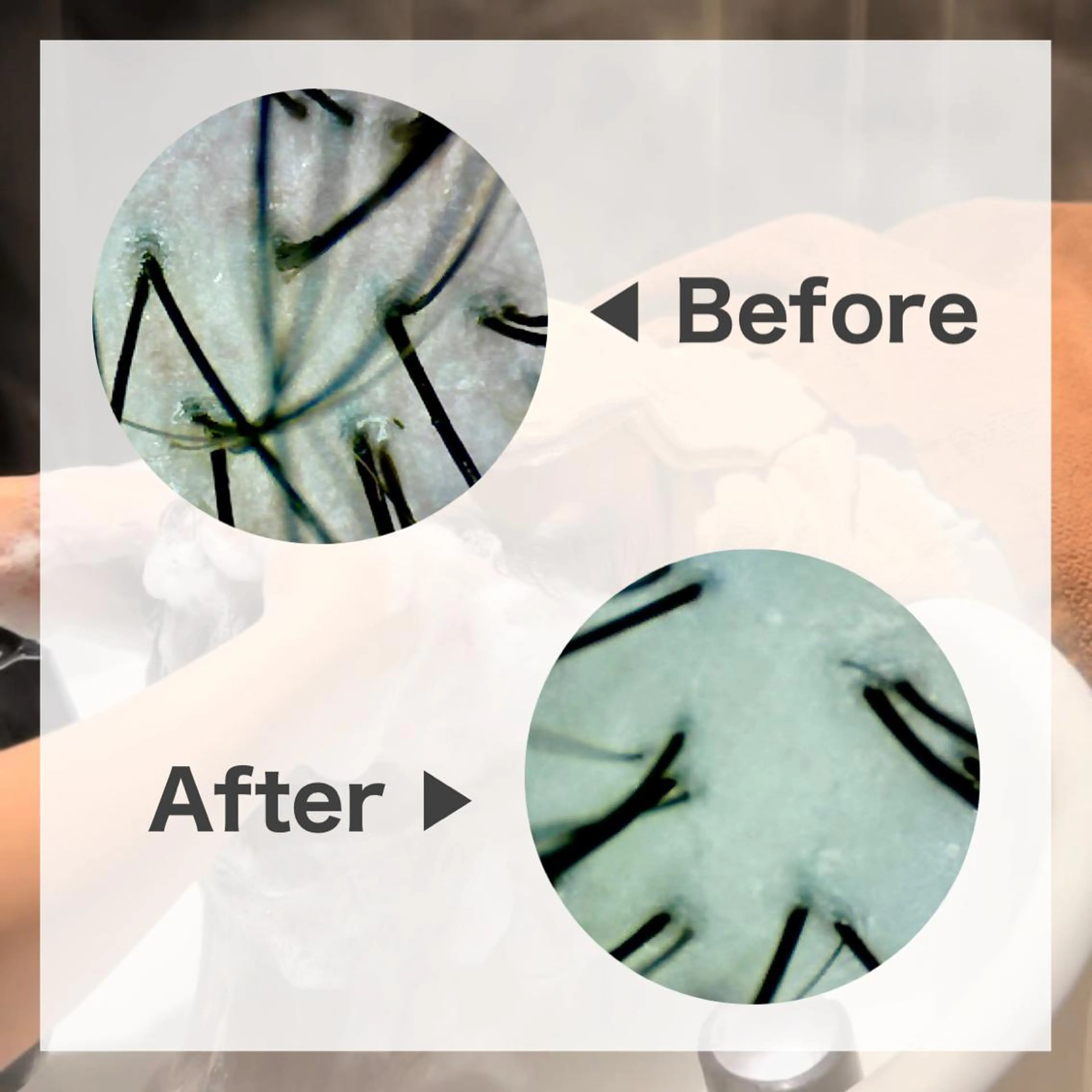 ミディアム 髪質改善 縮毛矯正 トリートメント 美髪ヘッドスパ🫧 西山紗奈江💆♀️のヘアスタイル