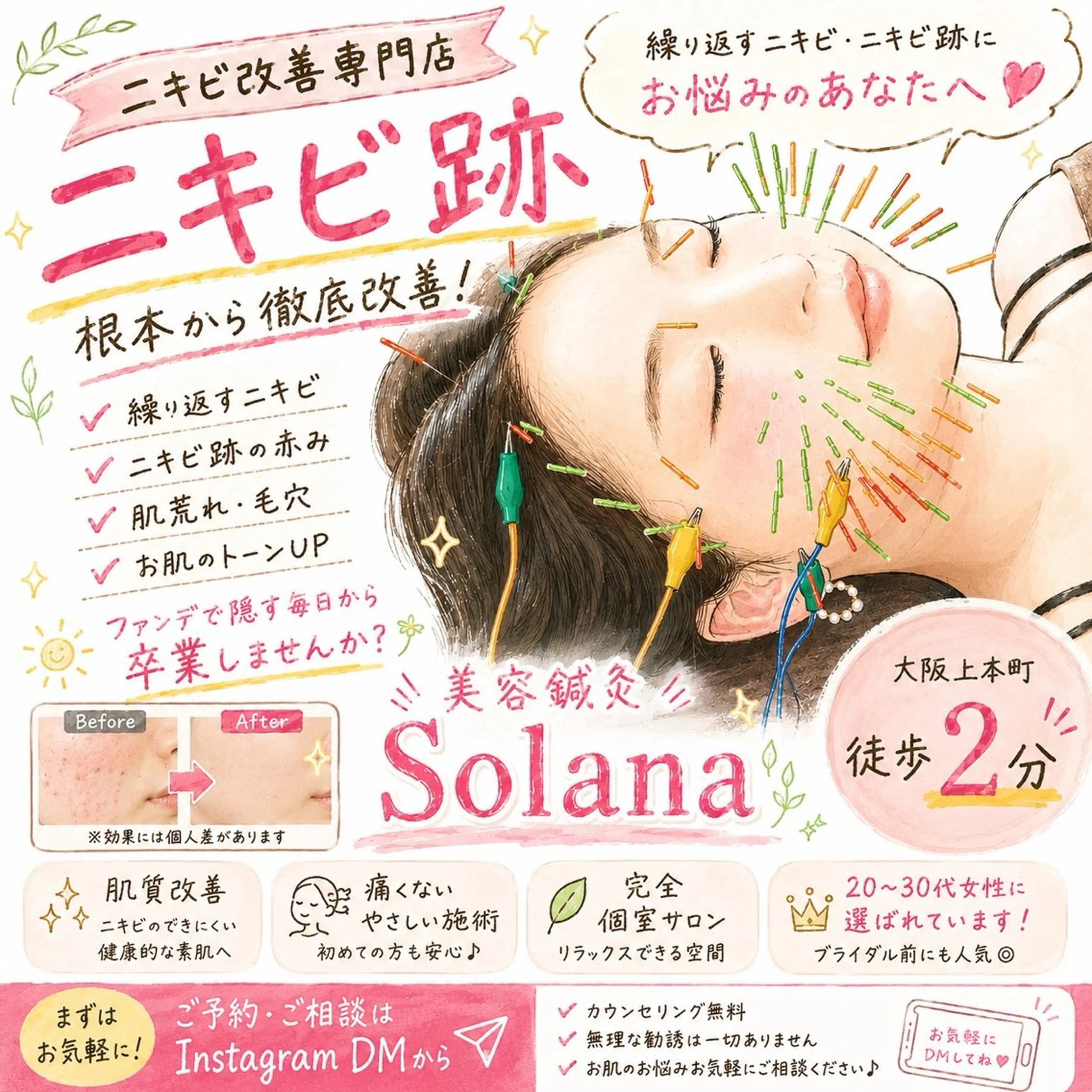エステ リラク 肌質改善×美容鍼 ゆいのエステ・リラクイメージ