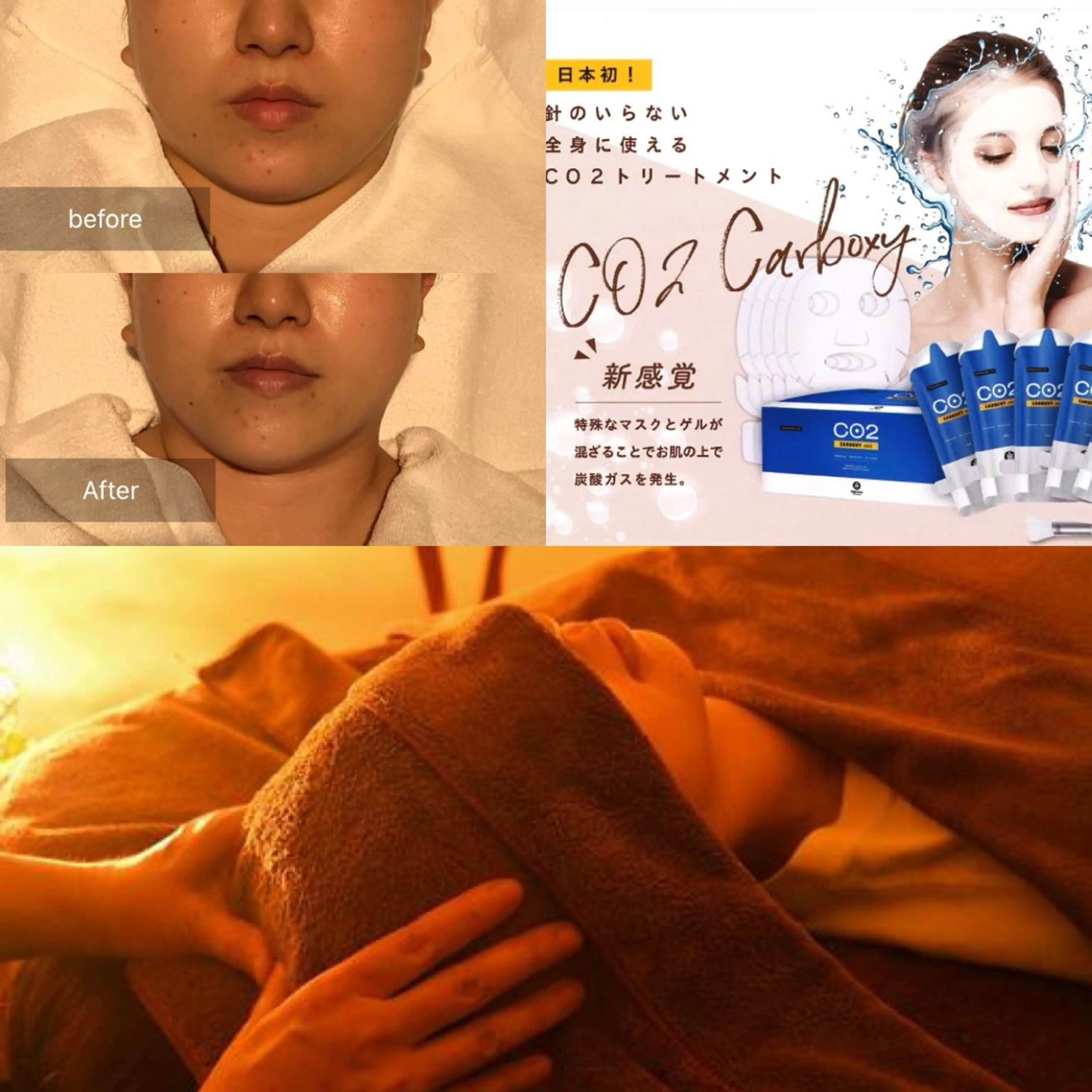 💎ボディエステ＆ 脱毛＆スパ💎山岡のエステ・リラクイメージ