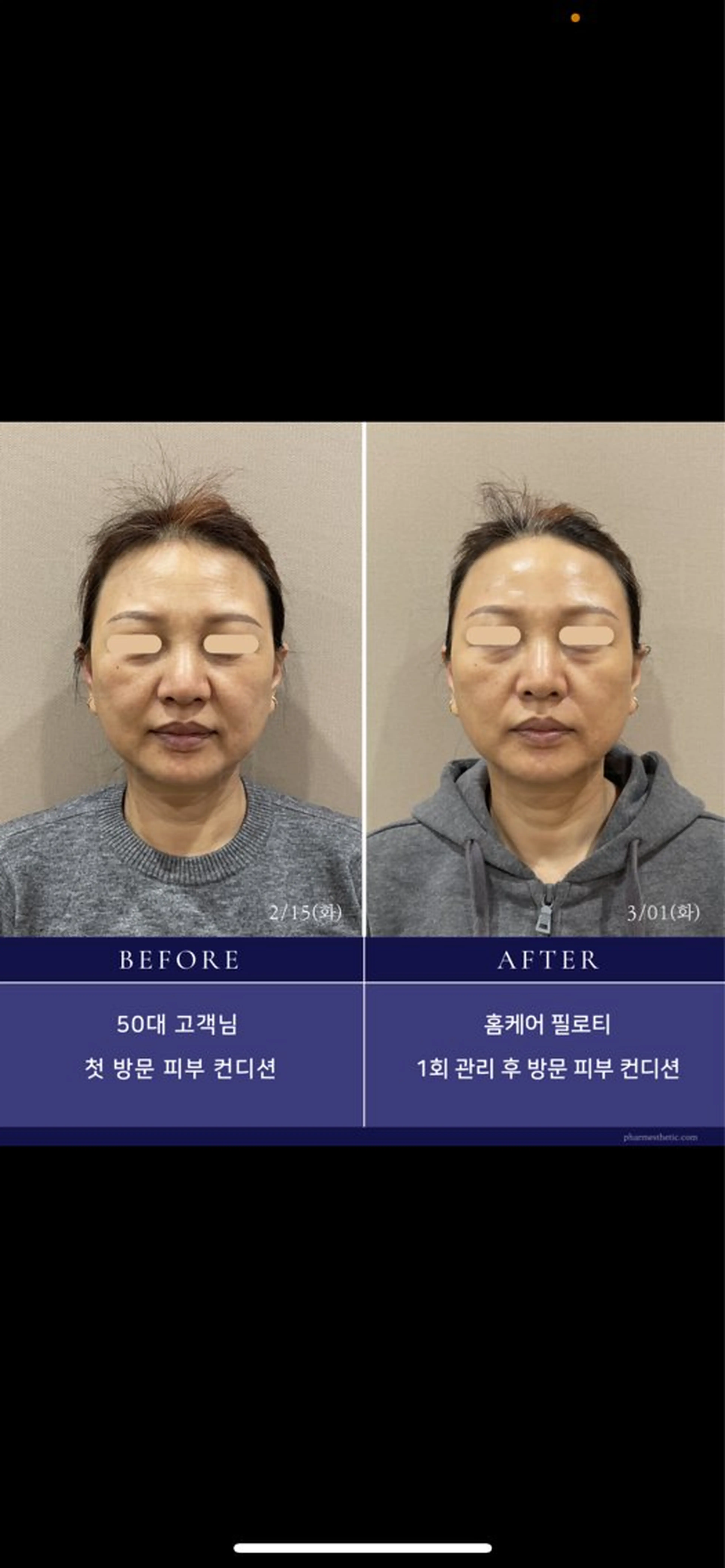 Monreve所属・美人スイッチdiet スーパージェクションのその他イメージ