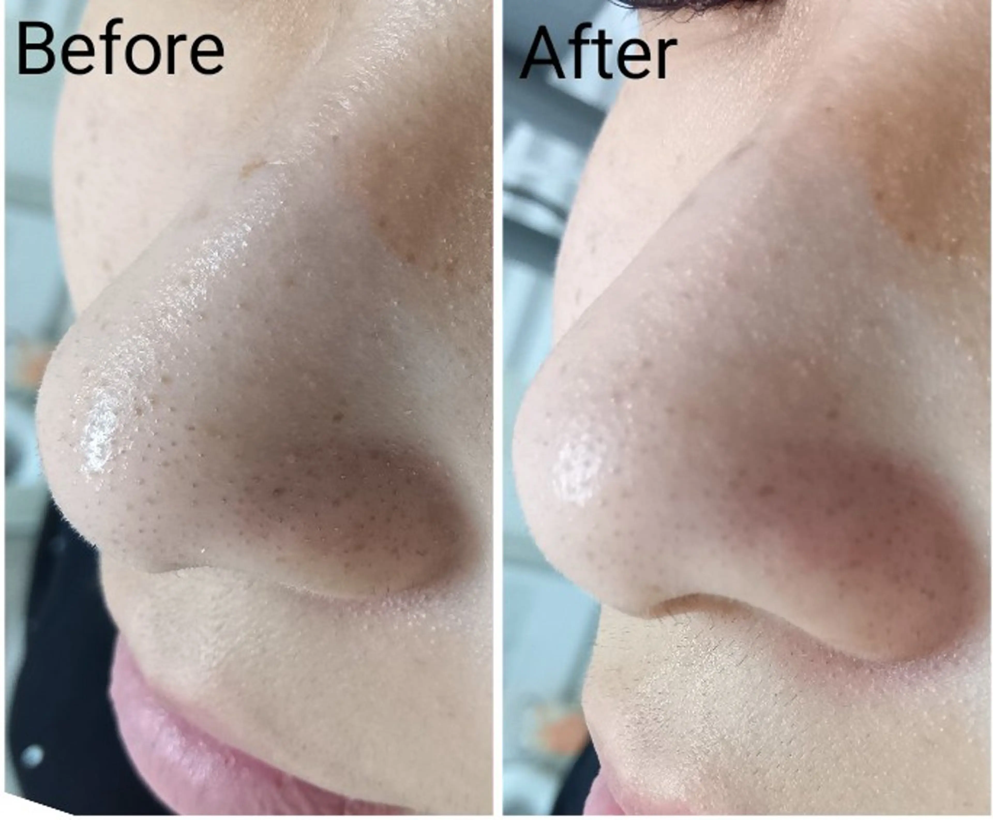 シミケア専門店 HAQUAのエステ・リラクイメージ