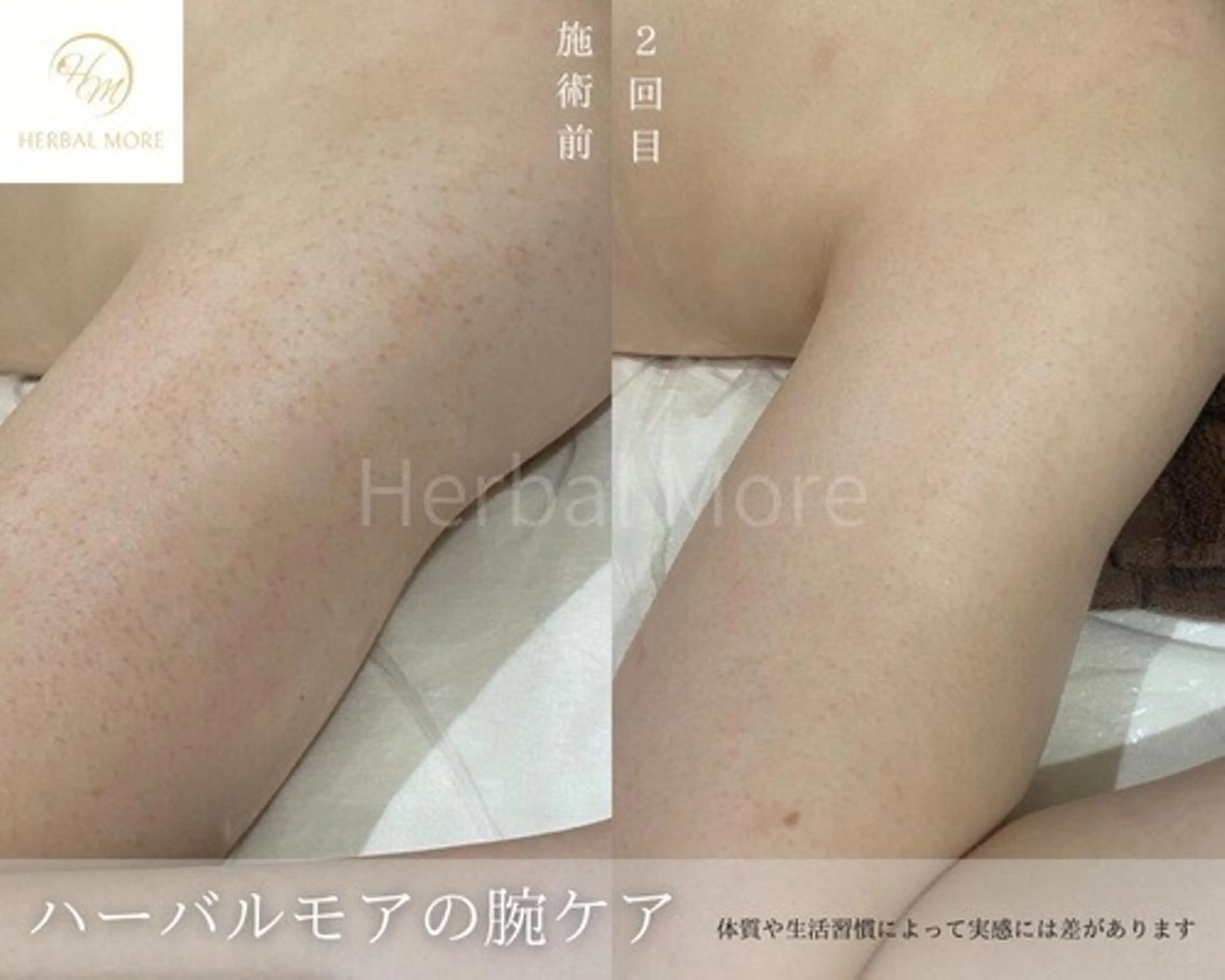 脱毛・眉毛・フェイス サロンN久留米店の眉毛・アイブロウイメージ