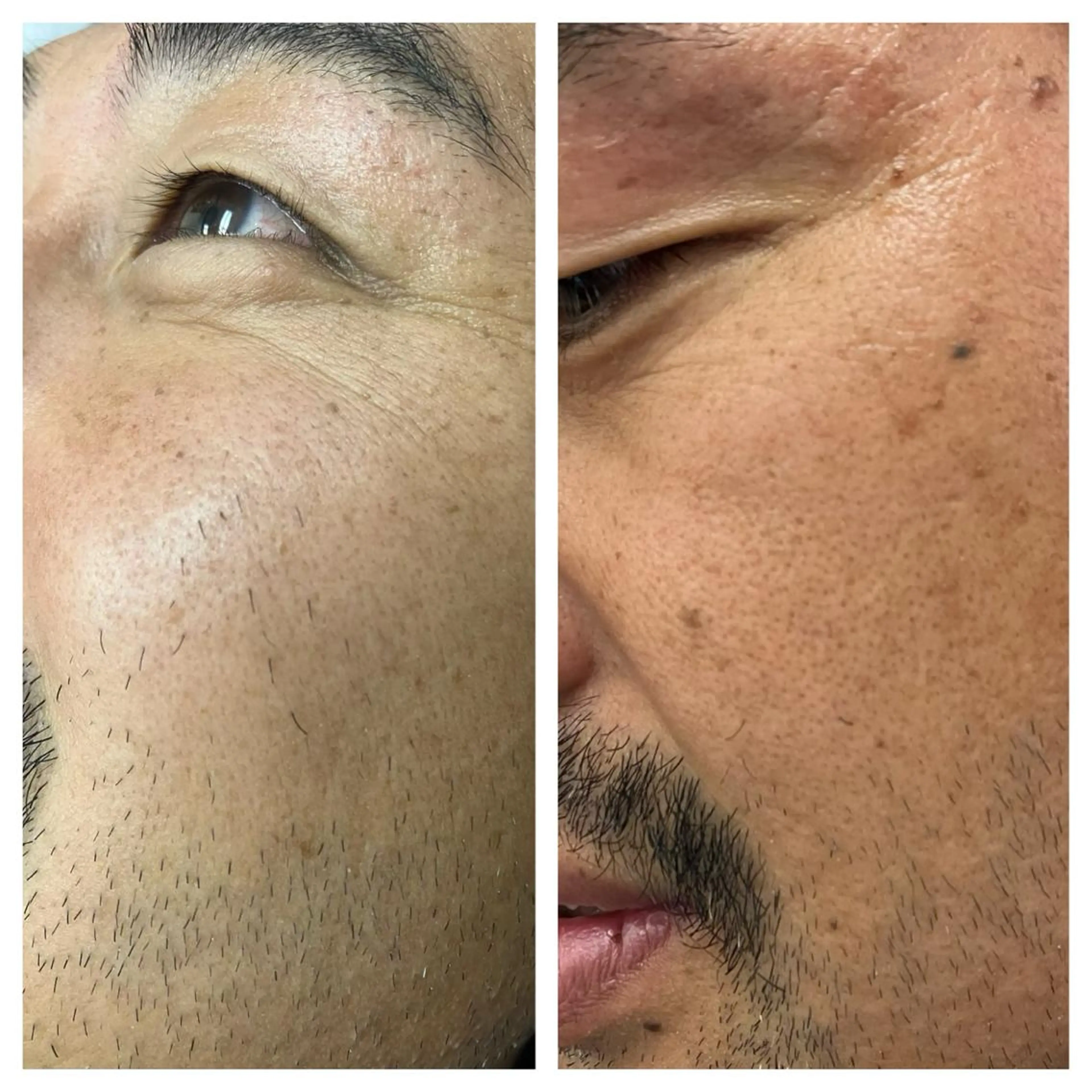 メンズ マツエク・マツパ アイブロウ 眉毛ワックス脱毛 MISEREL岡崎店 Ayaのエステ・リラクイメージ