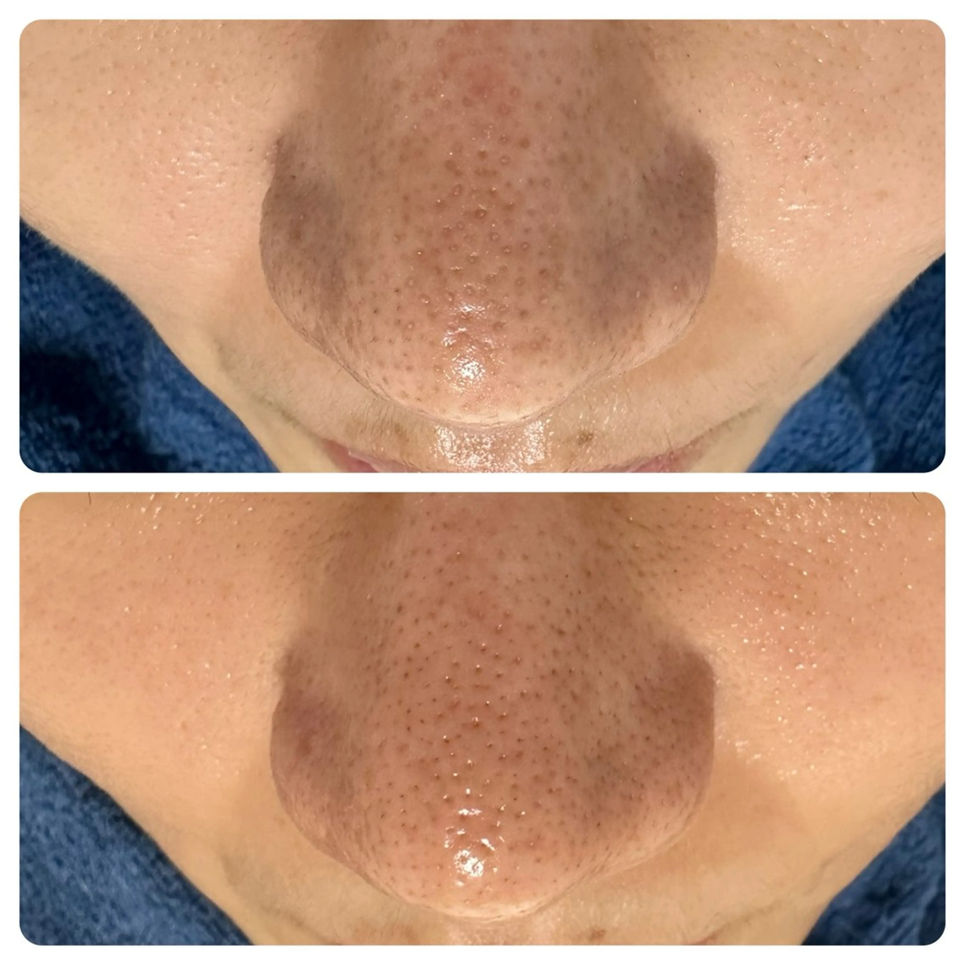 エステ 【赤ニキビ改善】 BELL'ET新宿店のエステ・リラクイメージ