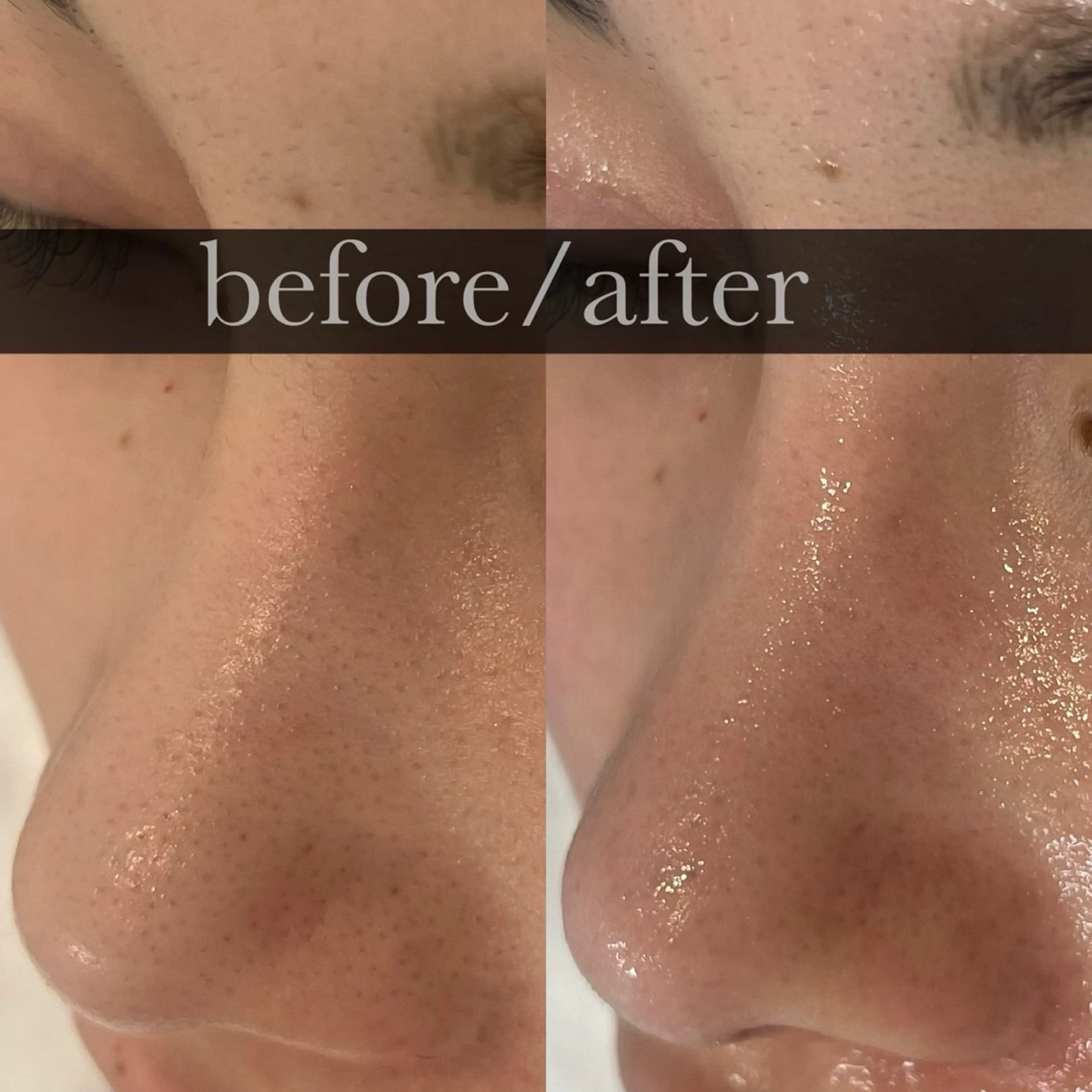 FOXYLASH inoueのエステ・リラクイメージ