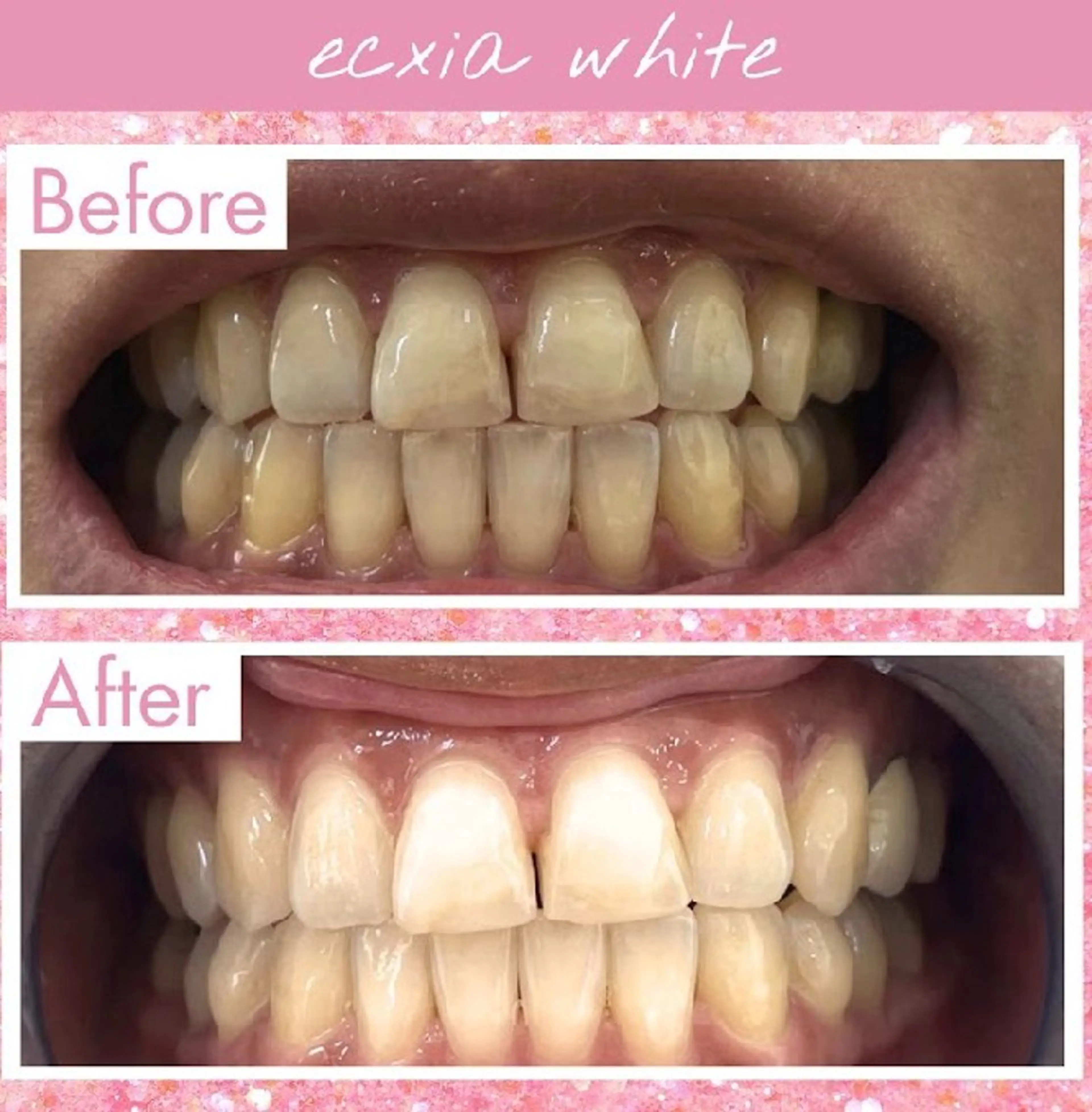 セルフホワイトニングサロンエクシアホワイト倉敷店所属・ecxiawhite 倉敷店のエステ・リラクイメージ