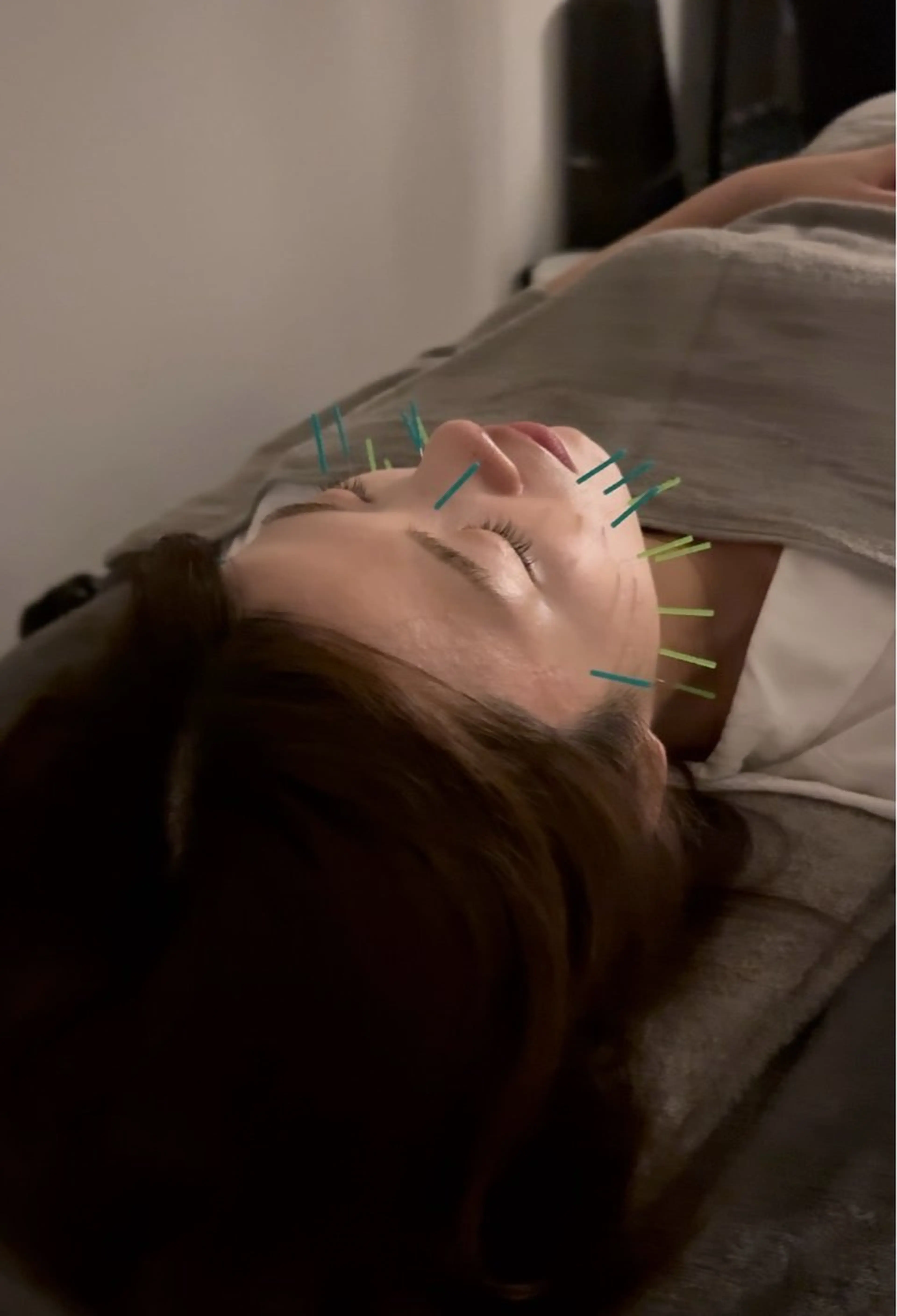 エステ 美容鍼×小顔矯正 ×美容整体　浜川泰仁のエステ・リラクイメージ