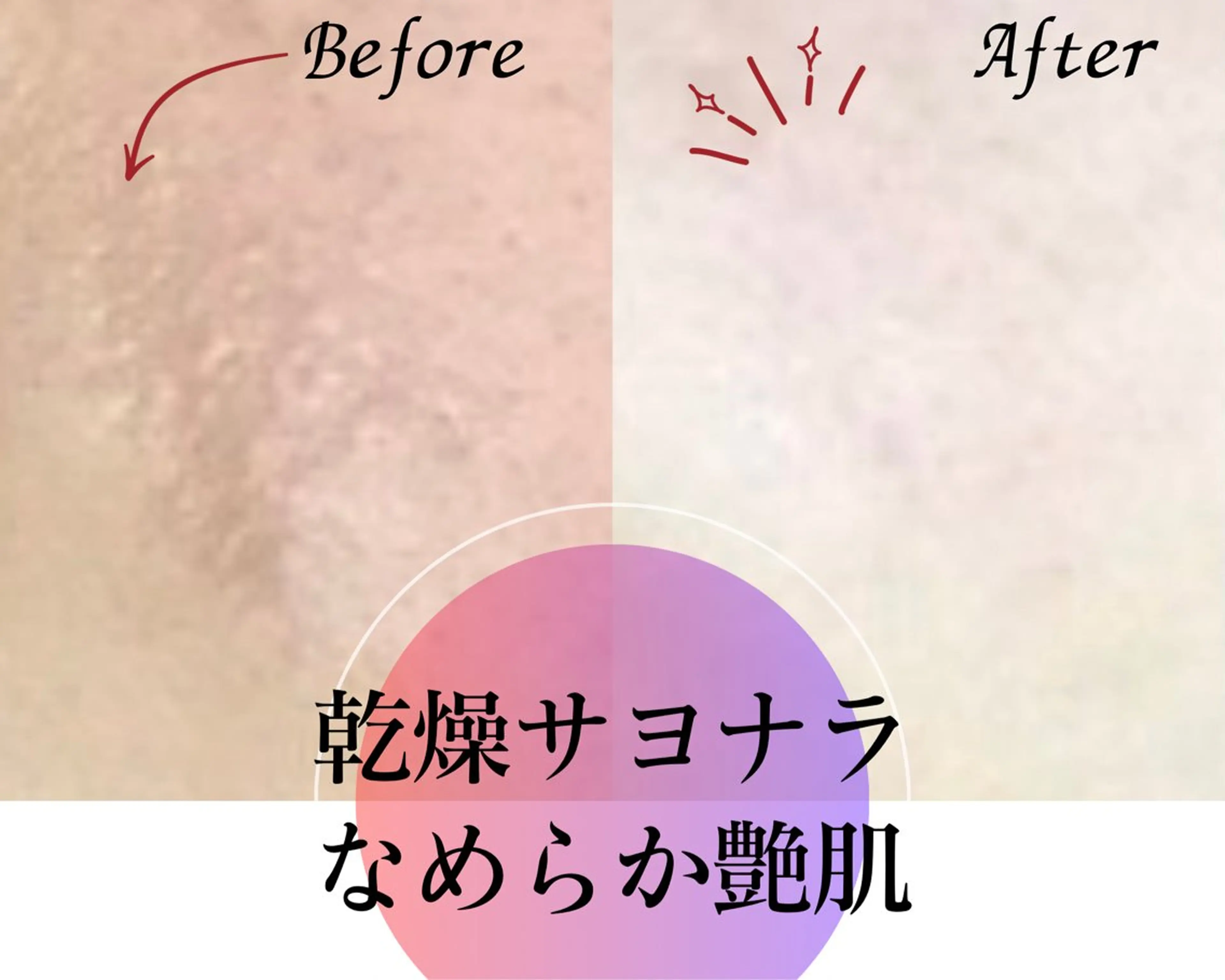 【毛穴→保湿】乾燥/ざらつき/開き/ニキビ　しっとりモチモチうる艶肌に！の写真