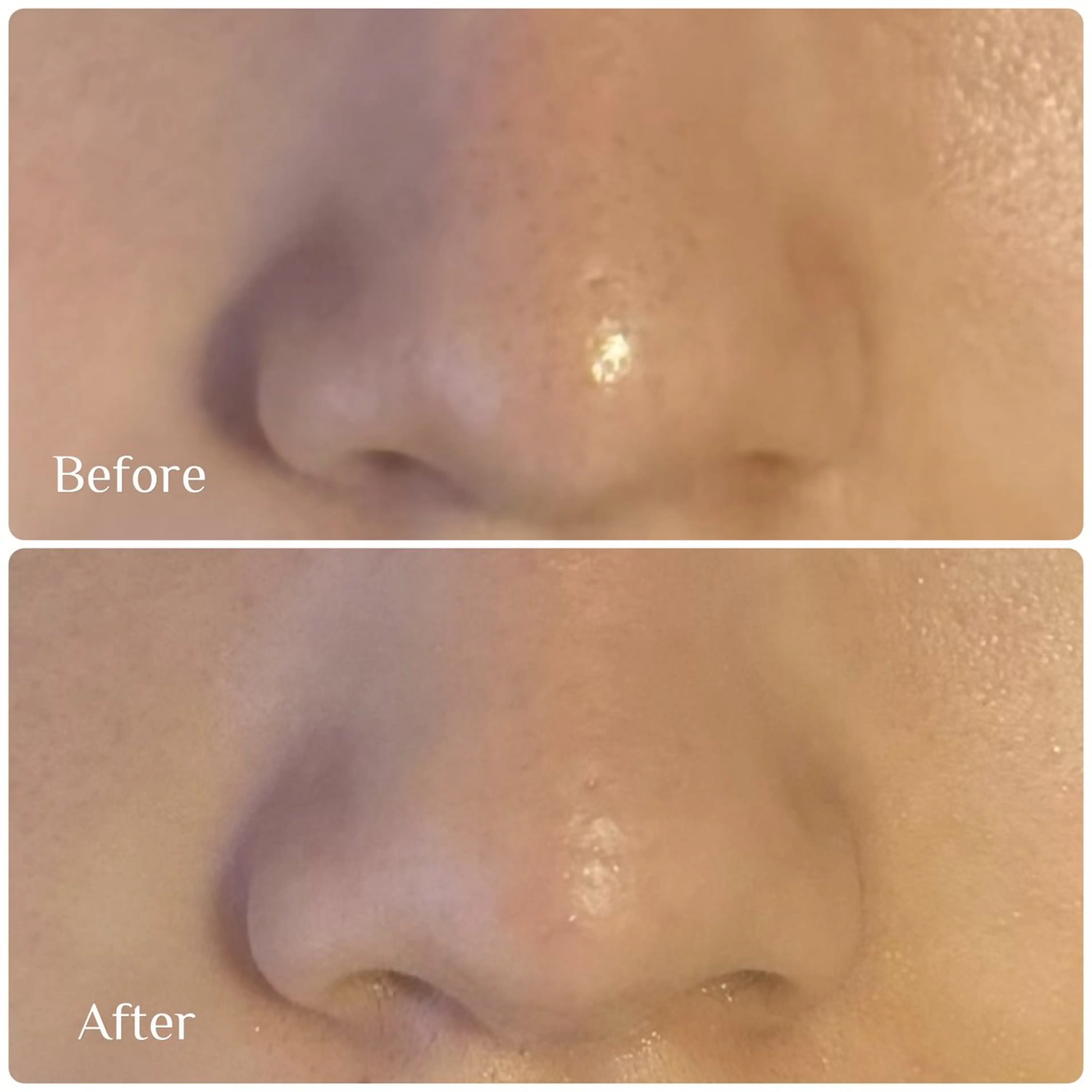 脱毛 フェイシャル soin～ソワン～のエステ・リラクイメージ