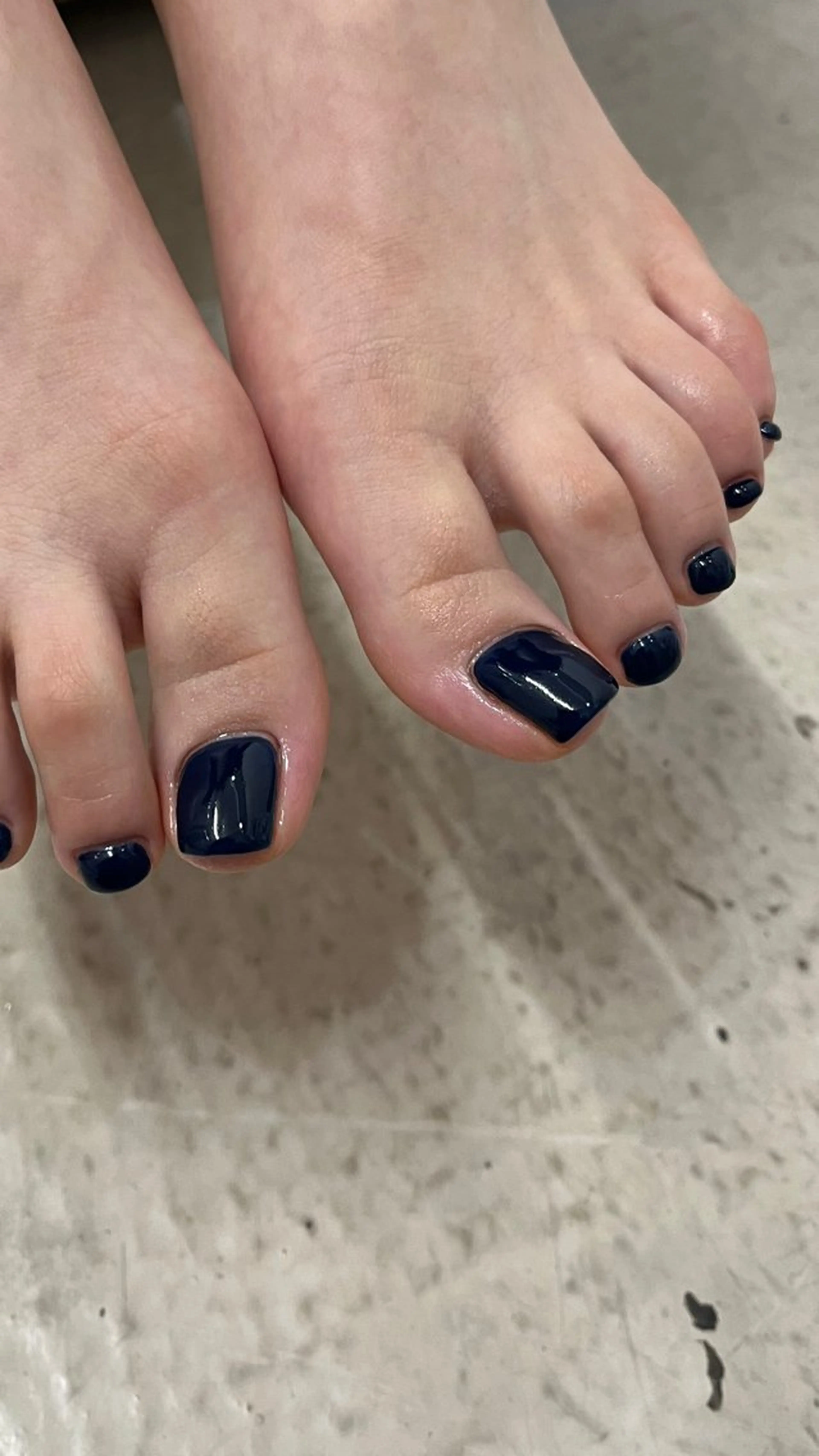 ネイル 甲村 未玖のネイルデザイン