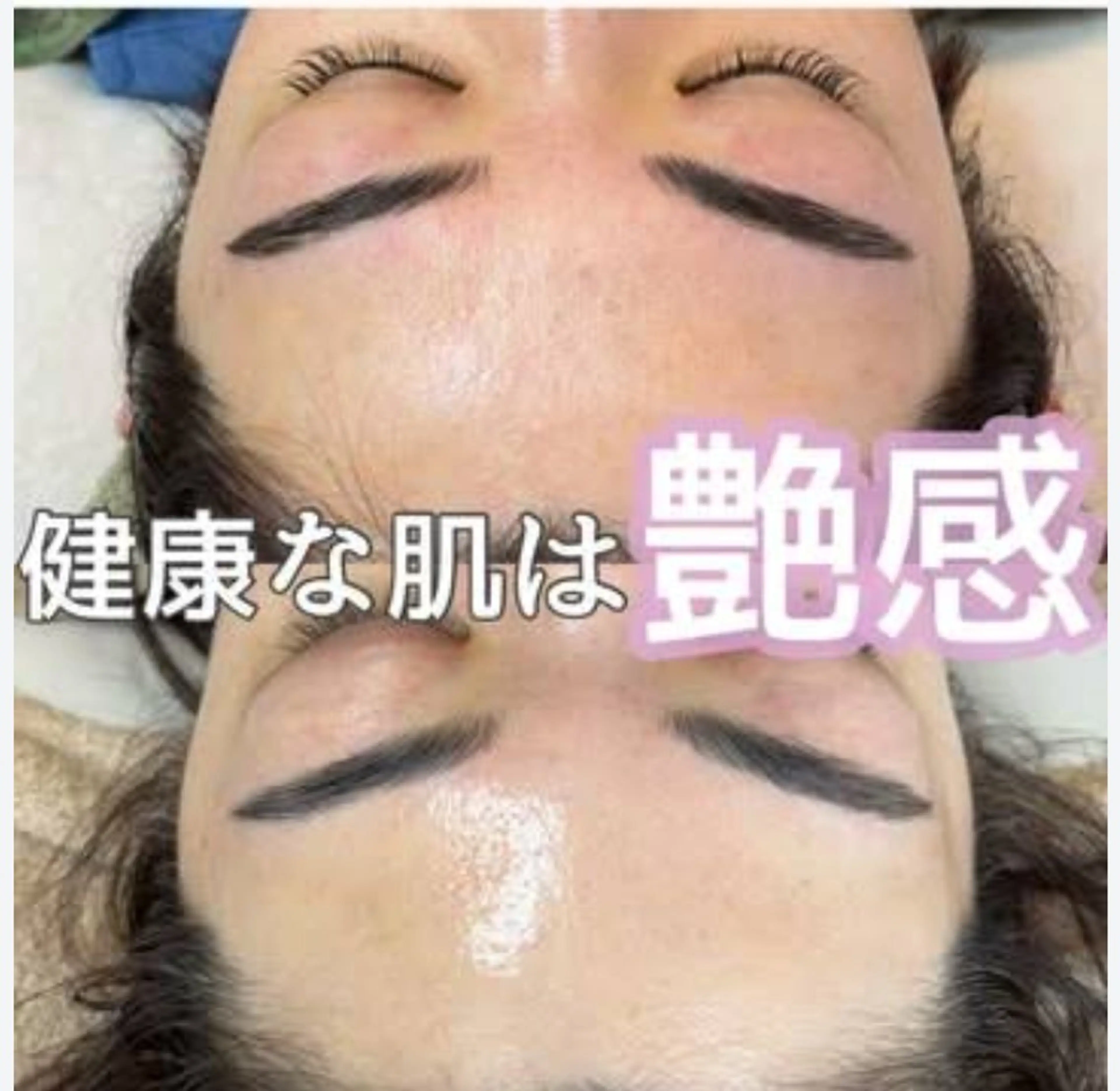 エステ エイジングケアサロンBIOEL所属・肌質改善BIOELプ ラズマ/ラミピールのエステ・リラクイメージ