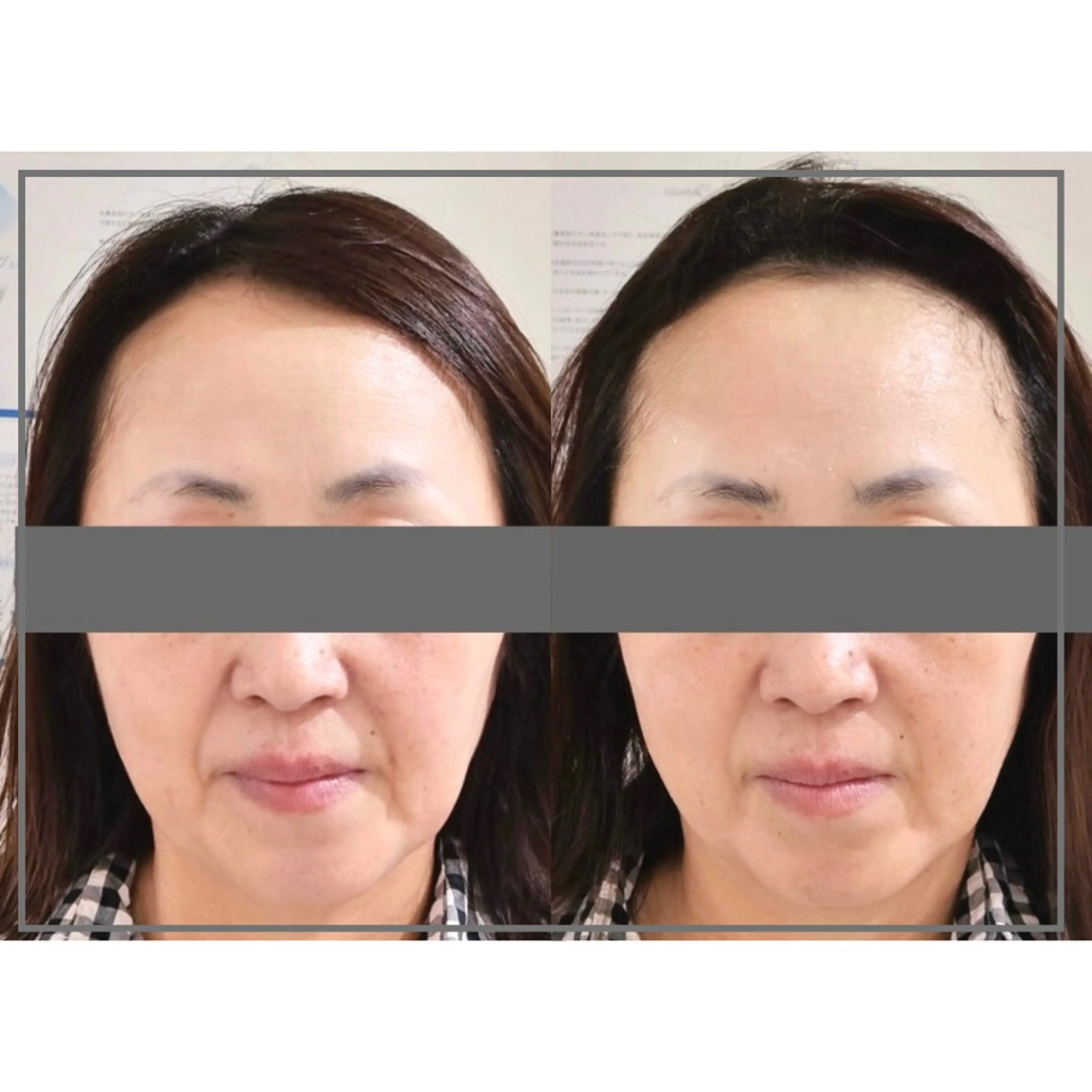 小顔・ツルツル素肌 ハリステリアのエステ・リラクイメージ