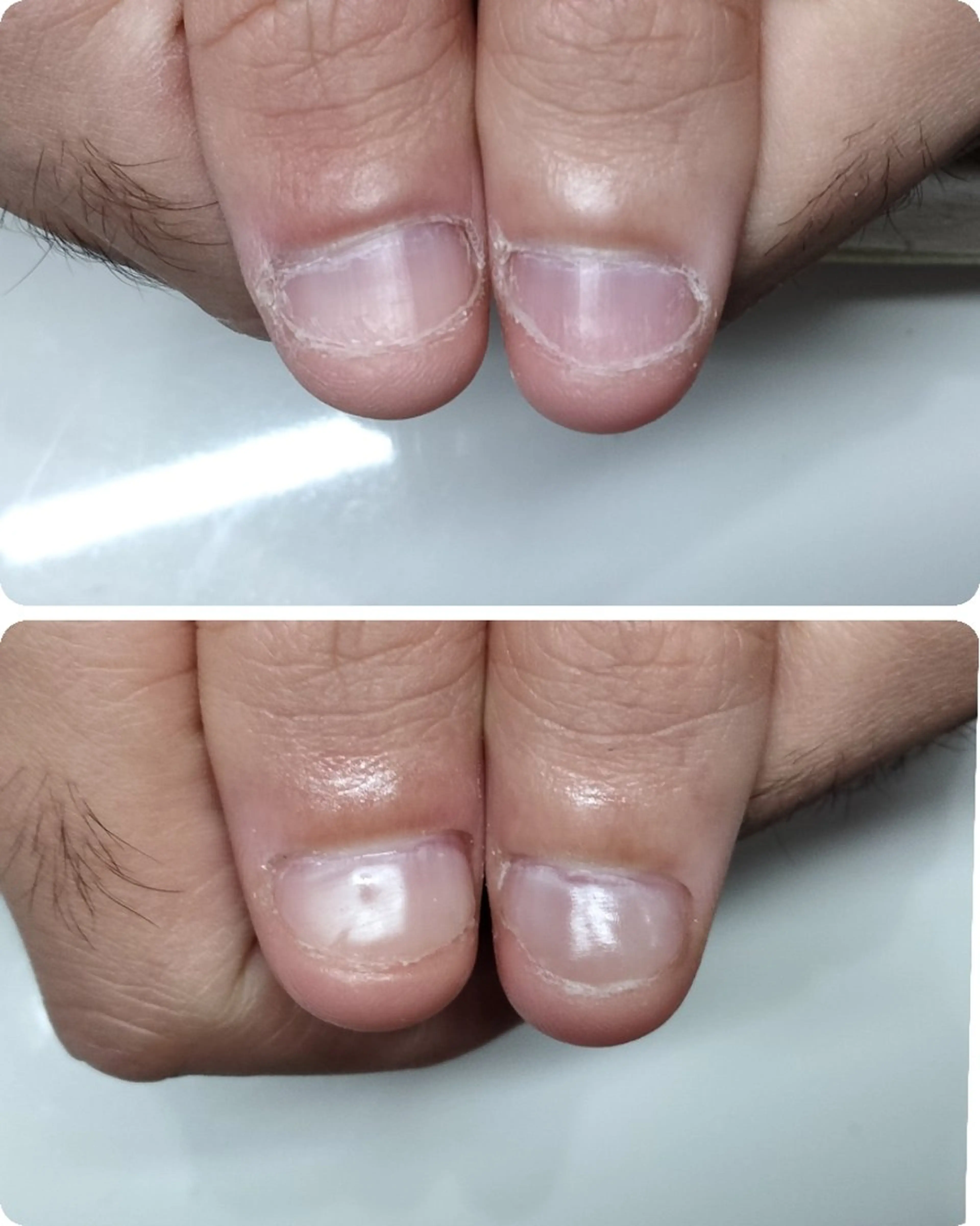 ネイル ネイルサロン アリュームのネイルデザイン