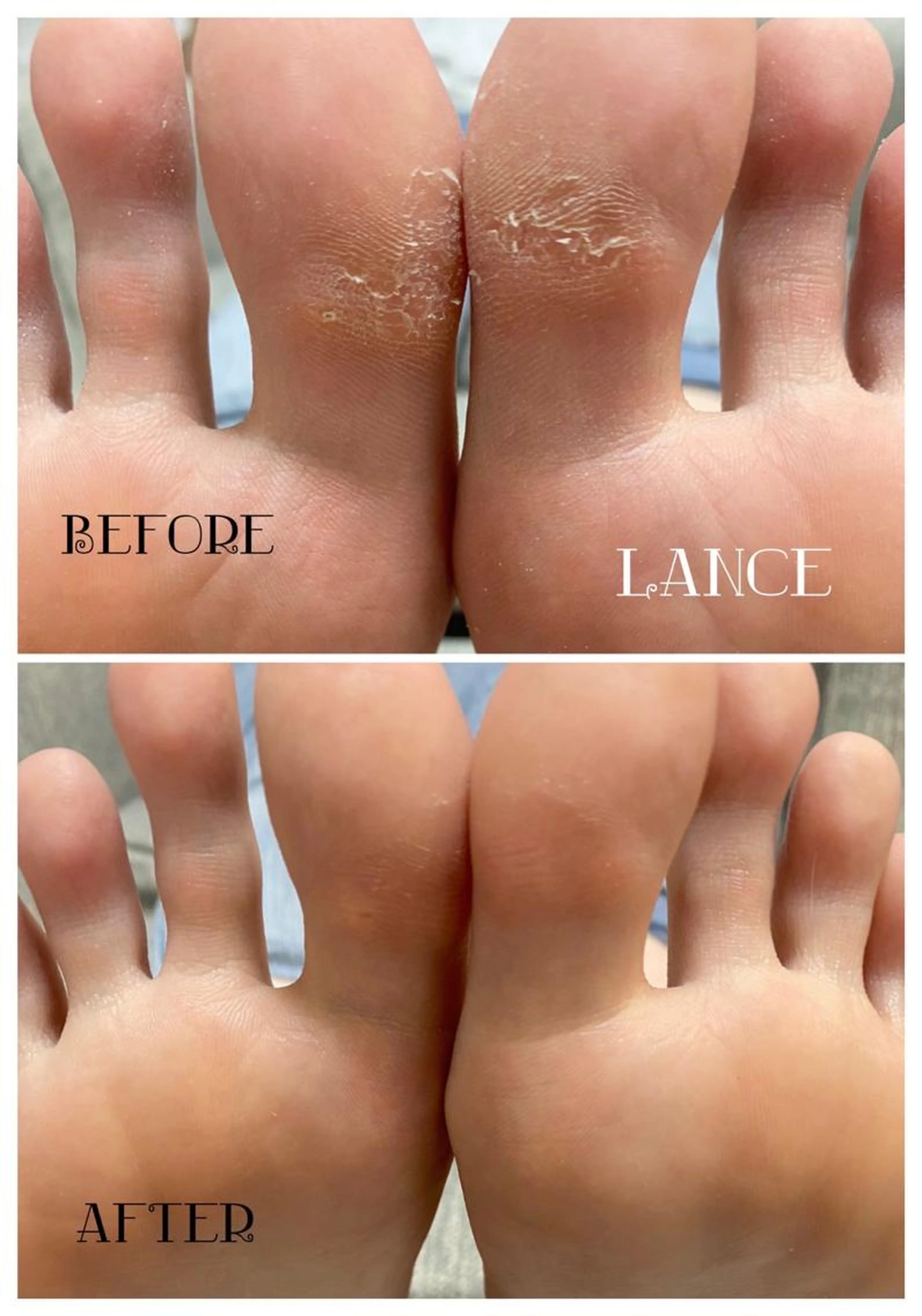 フット角質ケアコース🦶✴︎の写真