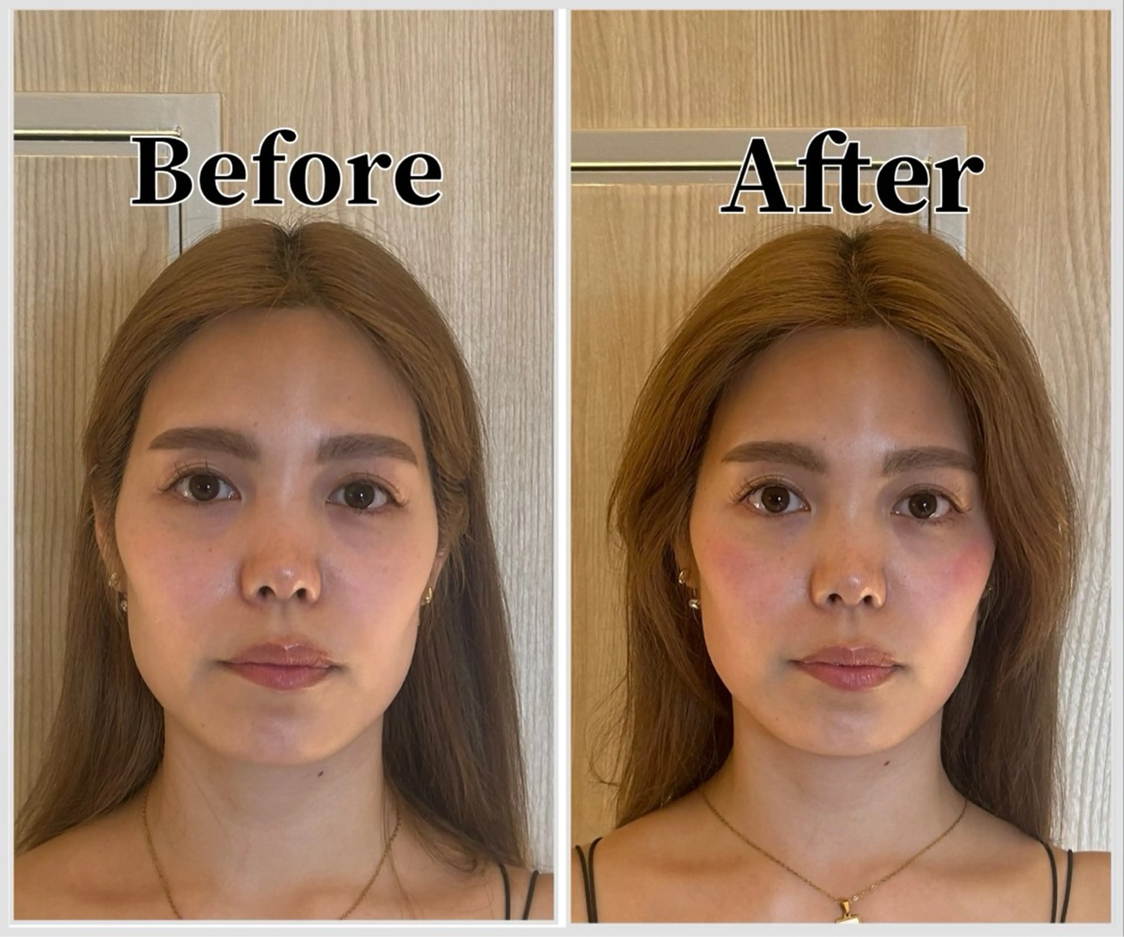 整体 LALUZ中目黒のその他イメージ