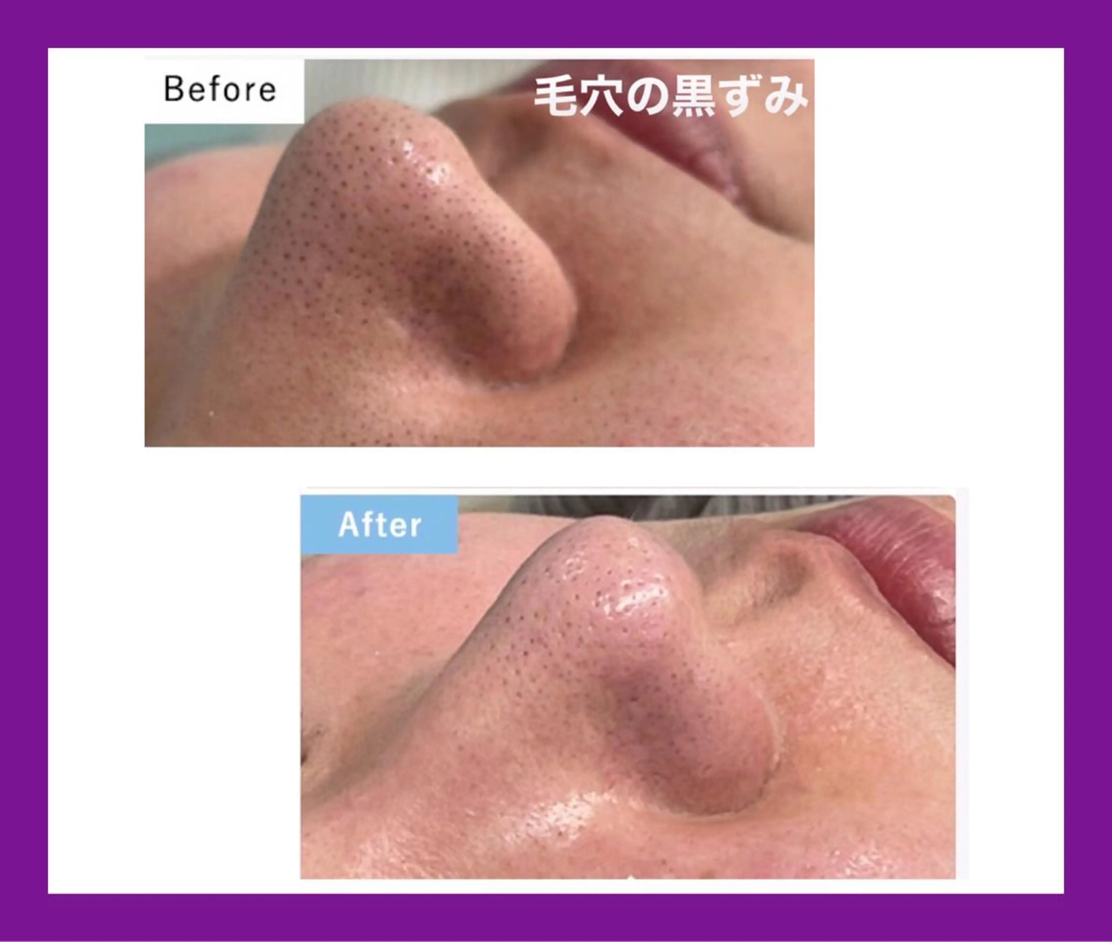 オーガニック エステ サロンフィオーレの眉毛・アイブロウイメージ