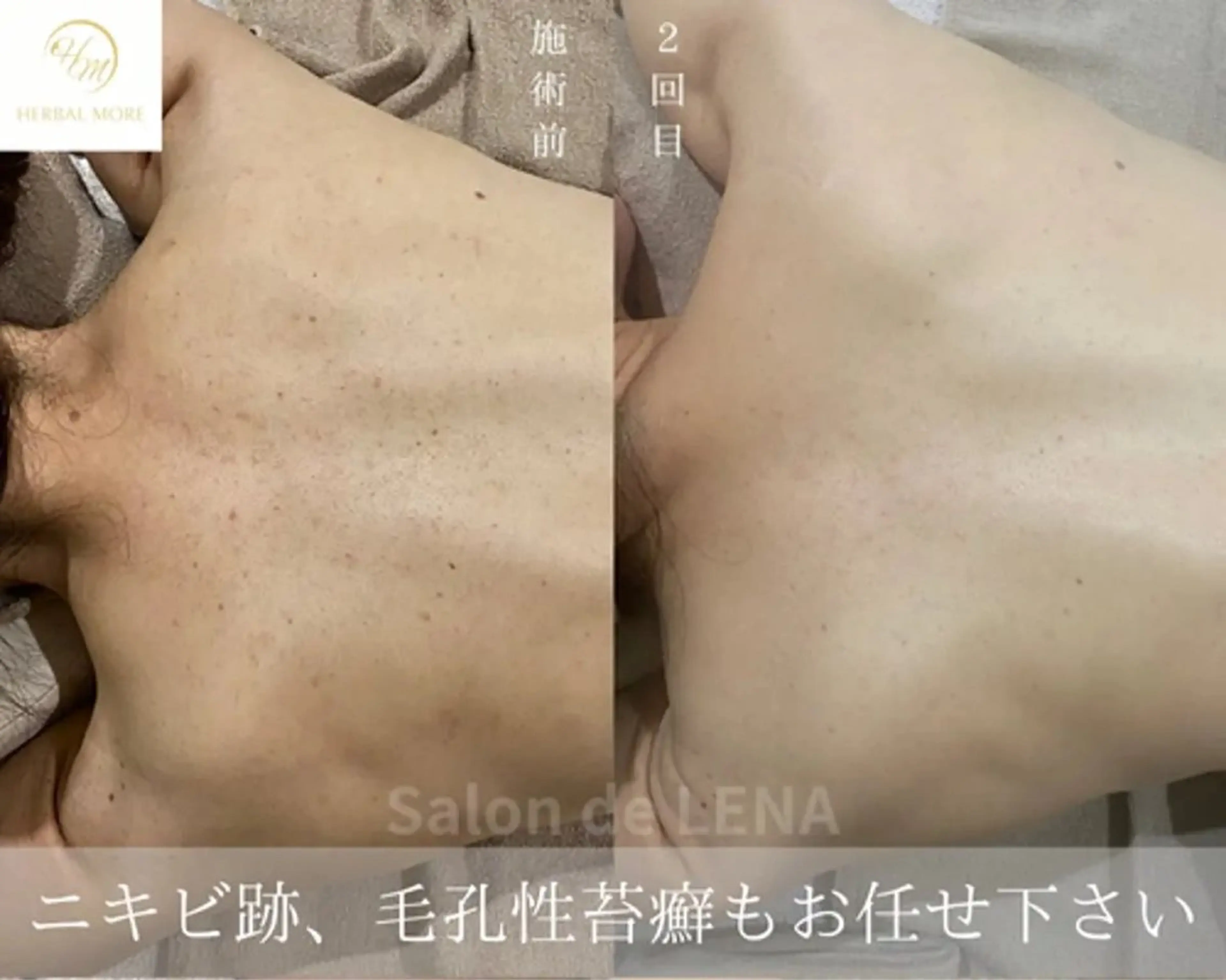 ハーブピーリング専門 グランディール　武内のエステ・リラクイメージ