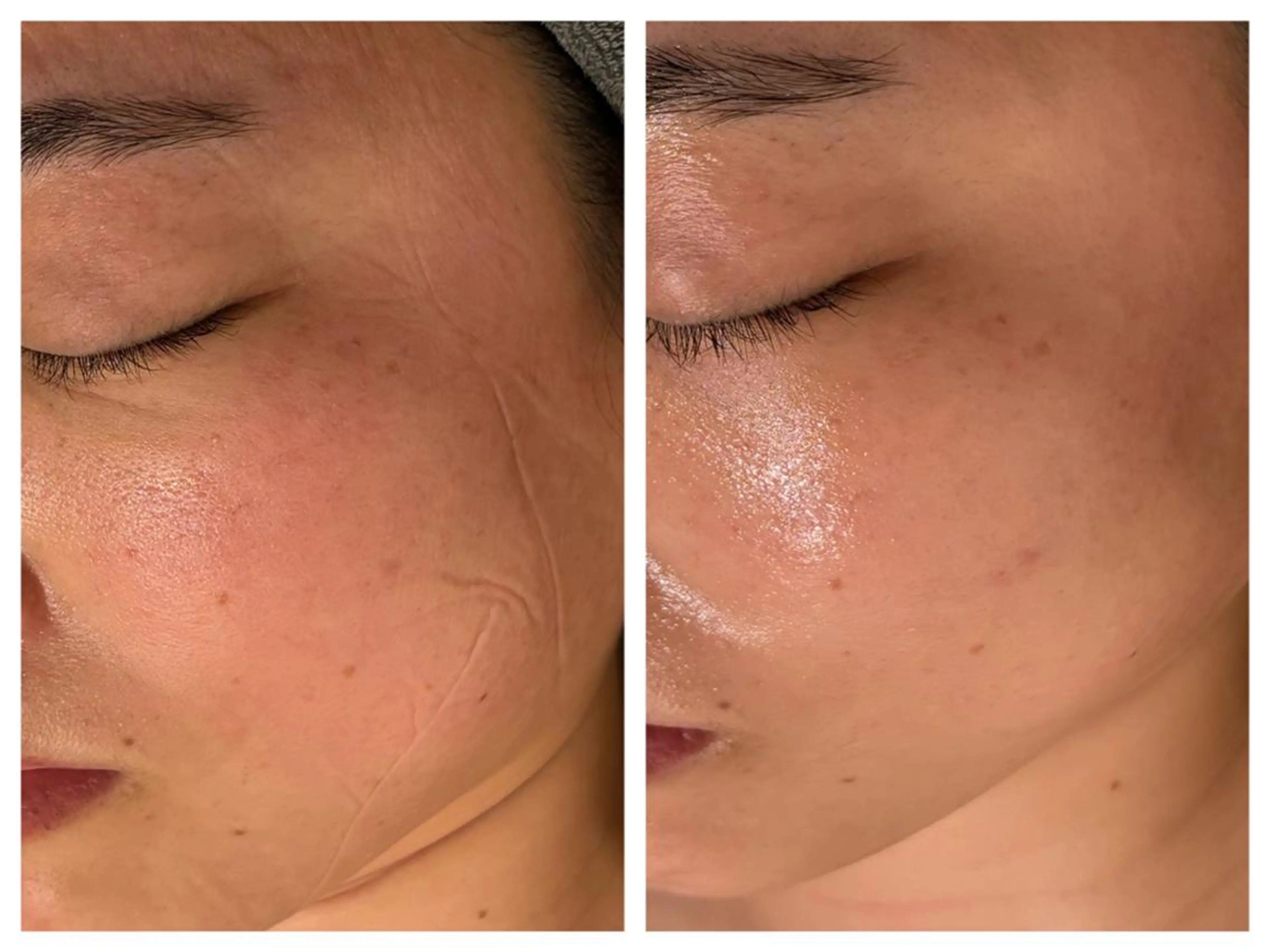 エステ リラク 小顔＆まつ毛サロン AKANE❤️のエステ・リラクイメージ