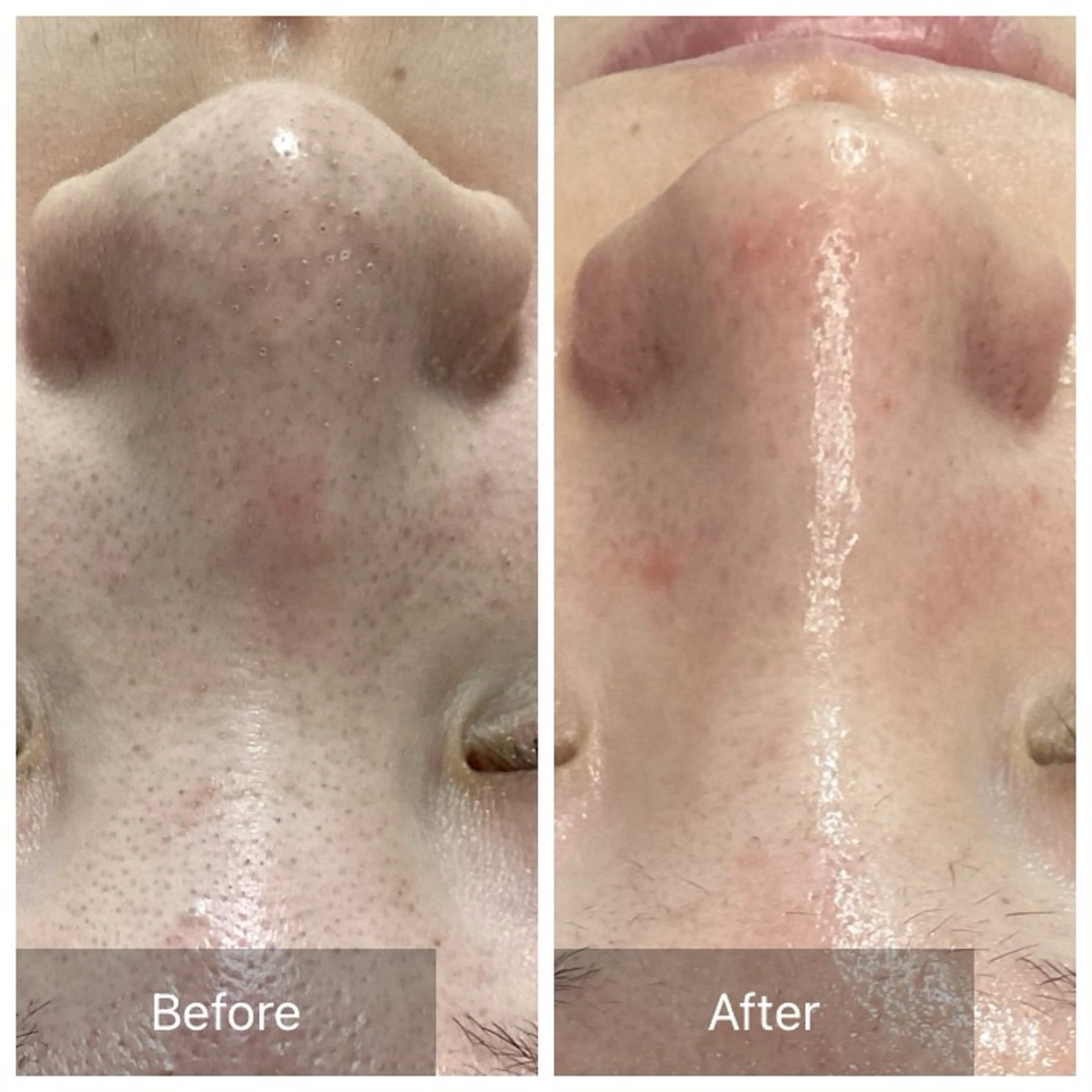 エステ Dahlia Moriのエステ・リラクイメージ