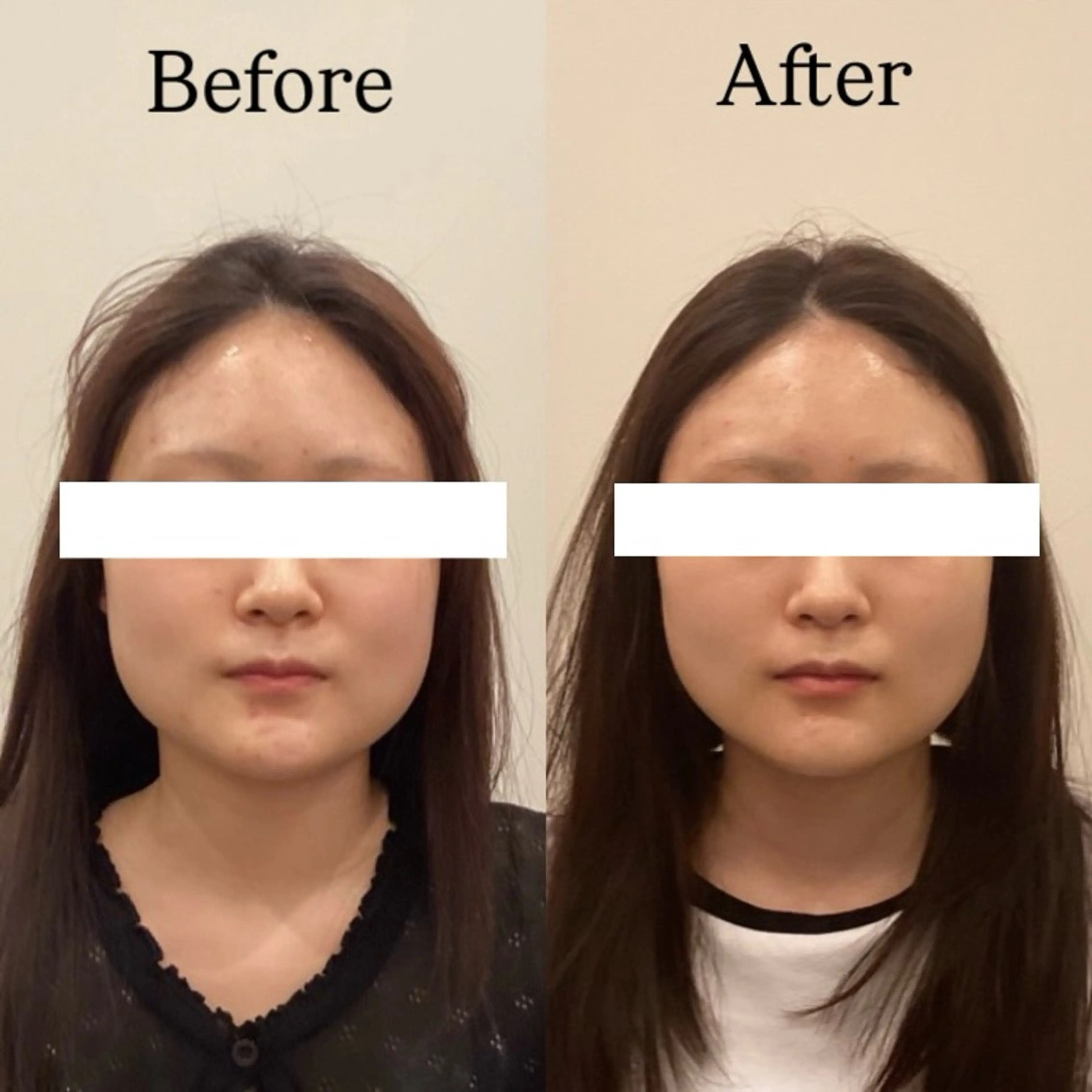 エステ リラク Hari Lounge恵比寿所属・chika🦋 ハリラウンジ恵比寿のエステ・リラクイメージ